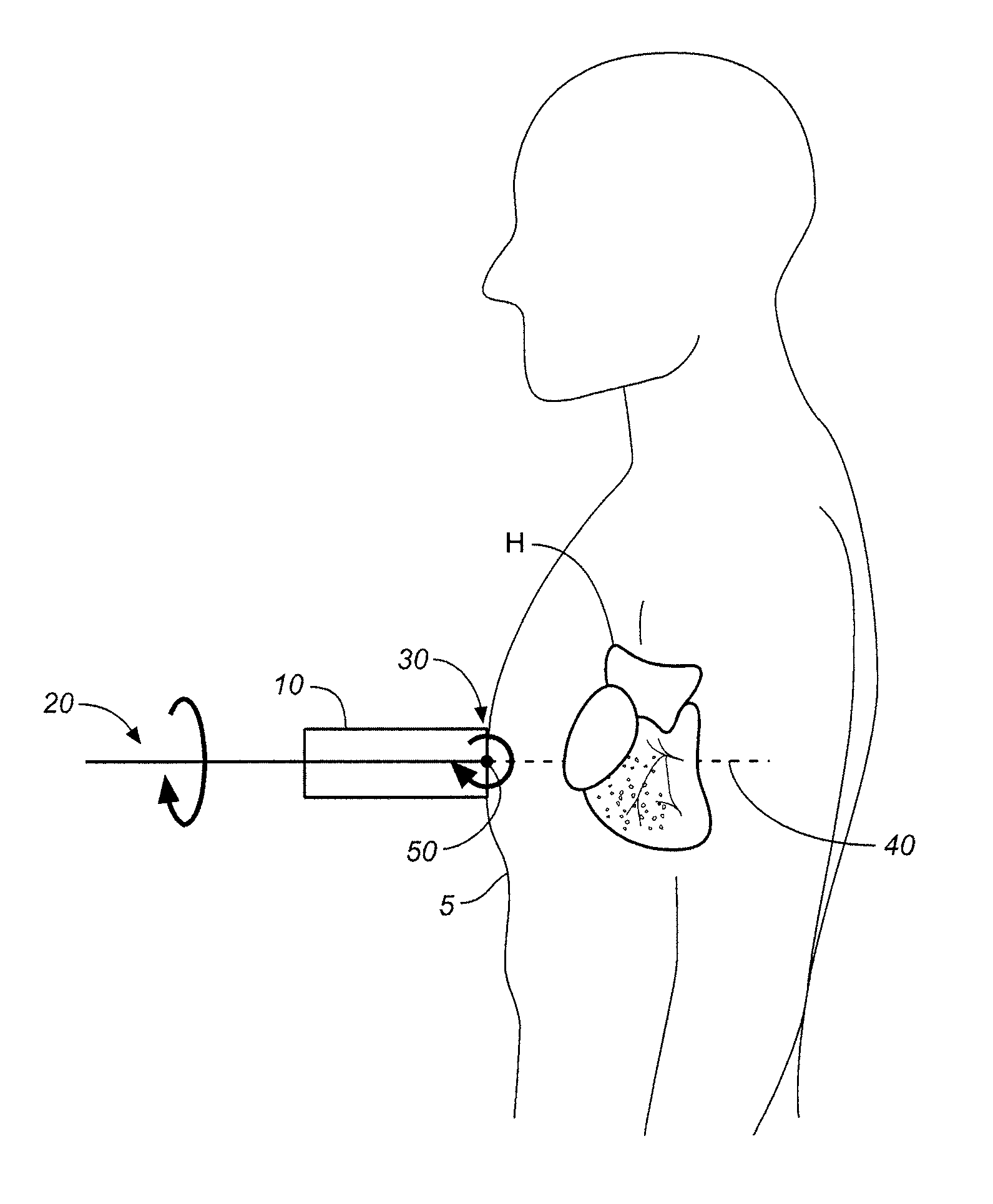 Method and apparatus to visualize the coronary arteries using ultrasound
