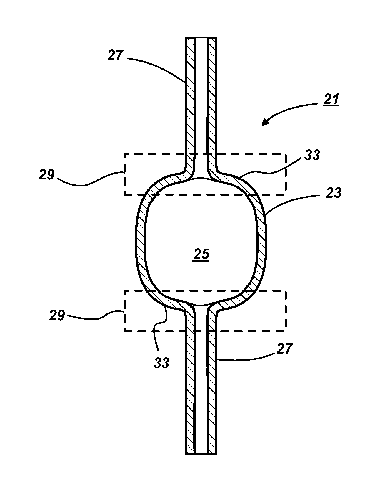 Ceramic discharge vessel having an opaque zone and method of making same