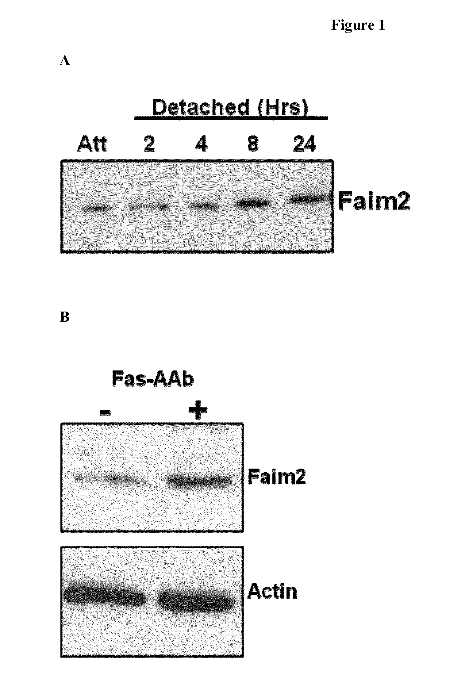 Methods of inhibiting photoreceptor apoptosis by eliciting the Faim2 antiapoptotic pathway