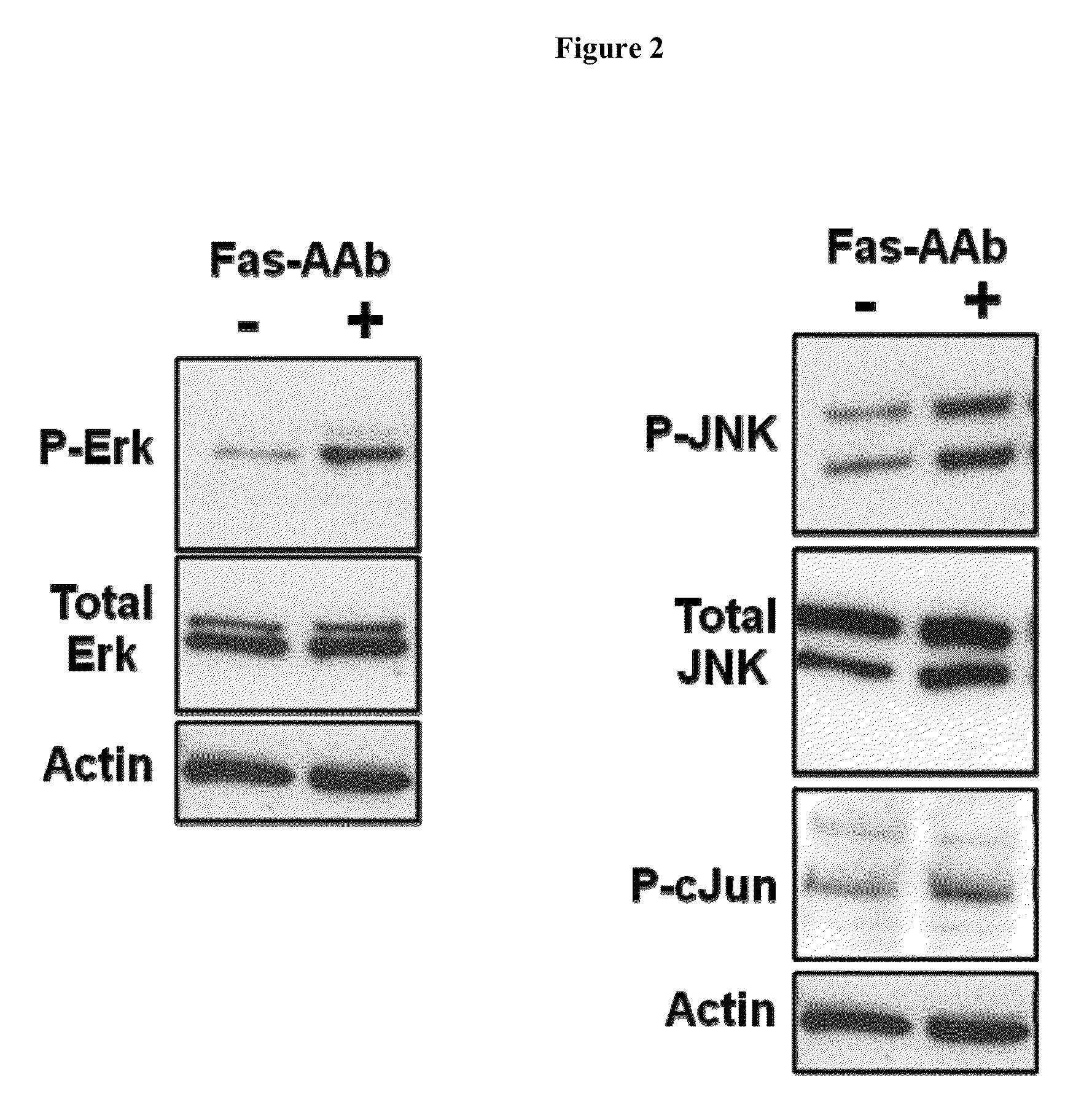 Methods of inhibiting photoreceptor apoptosis by eliciting the Faim2 antiapoptotic pathway