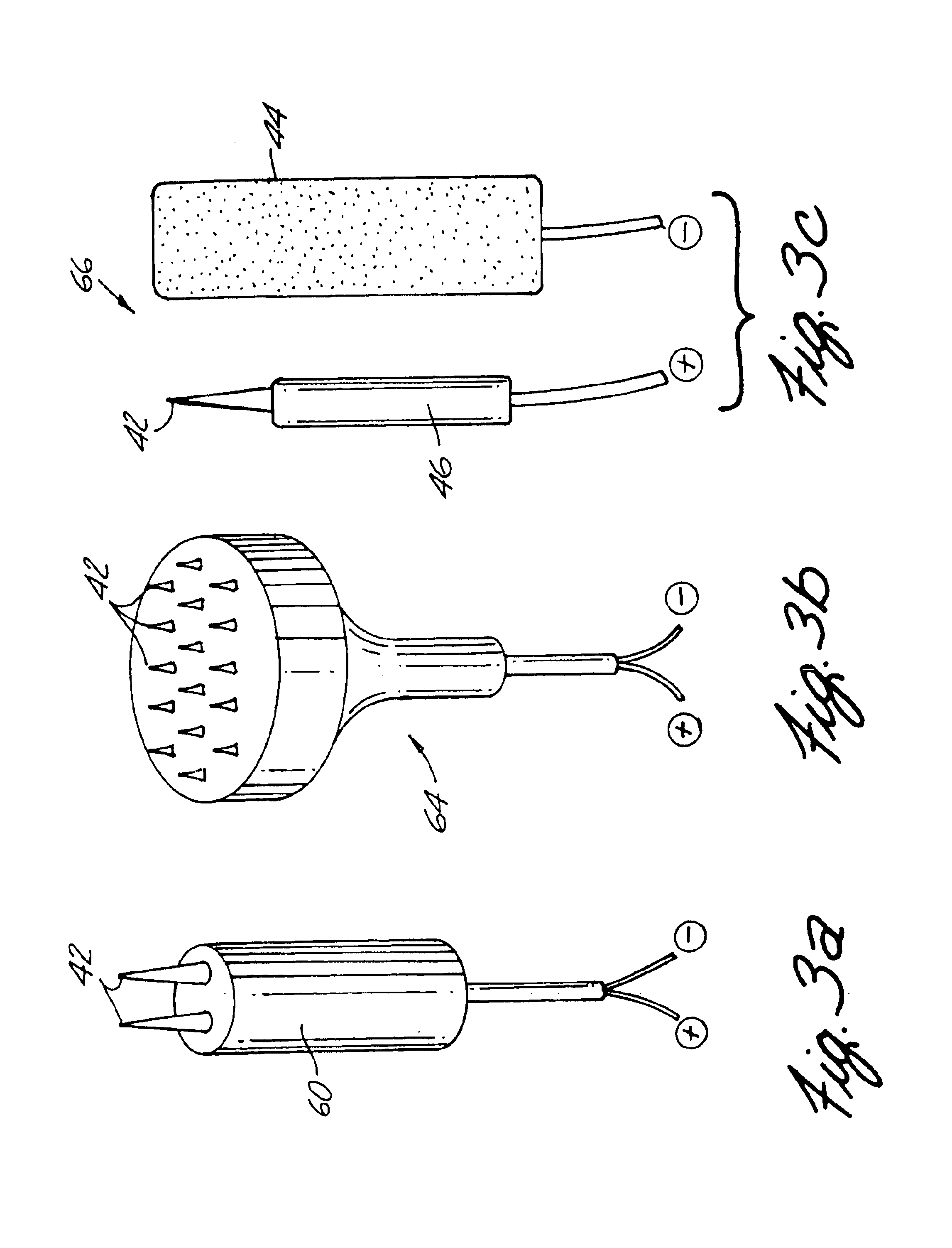 Apparatus and method for reducing subcutaneous fat deposits, virtual face lift and body sculpturing by electroporation