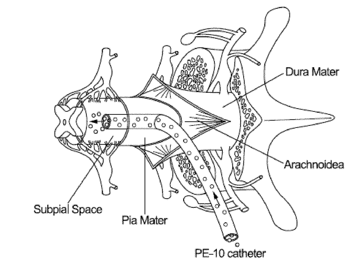 Spinal subpial gene delivery system