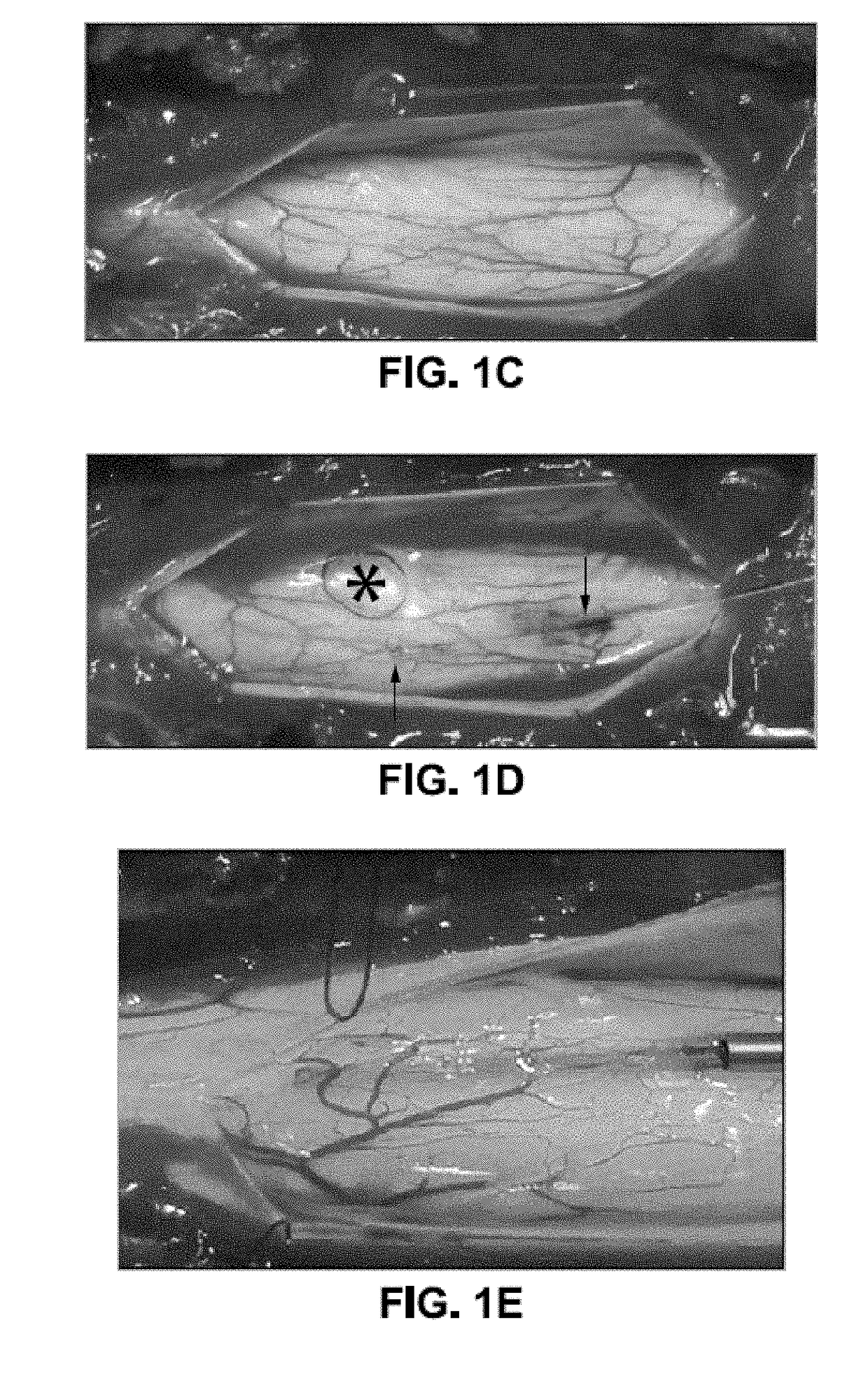 Spinal subpial gene delivery system