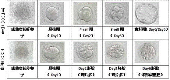 Application of miR-509-3p expression inhibitor in preparation of polycystic ovary syndrome treatment drugs