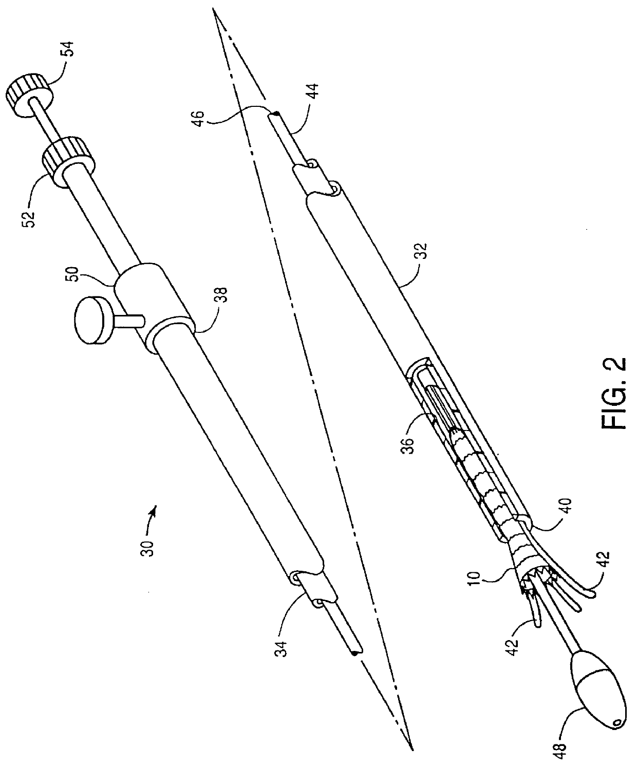 Stitched stent grafts and methods for their fabrication