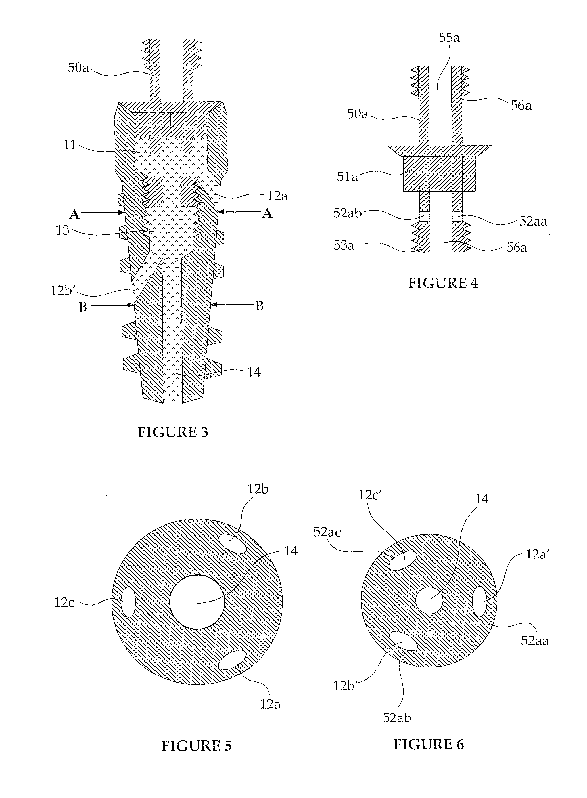 Method for Pretreatment of Wastewater and Recreational water with Nanocomposites