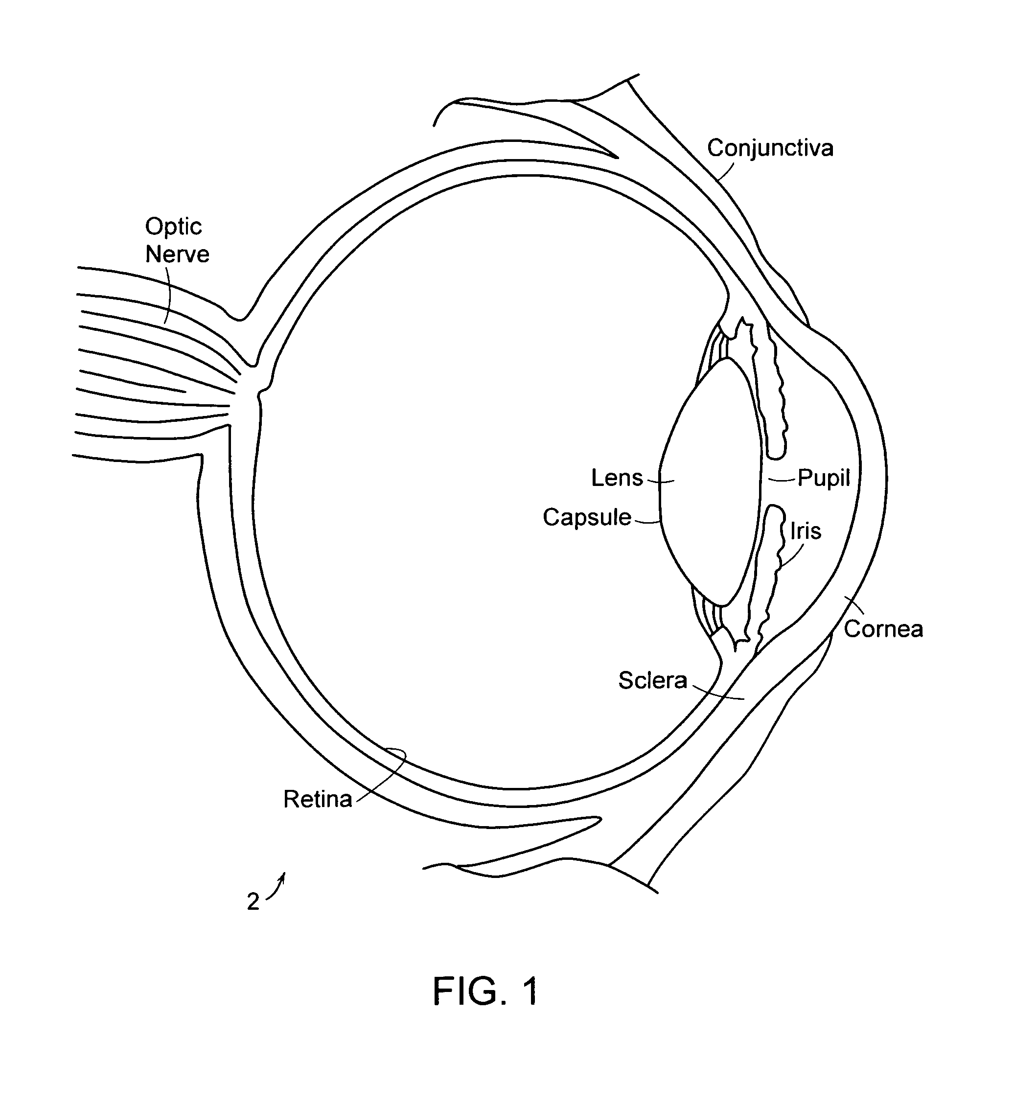 Injectable bag intraocular lens system, inserting device for use therewith, method for inserting an injectable bag intraocular lens within a human eye, methods for treating aphakia and system kits