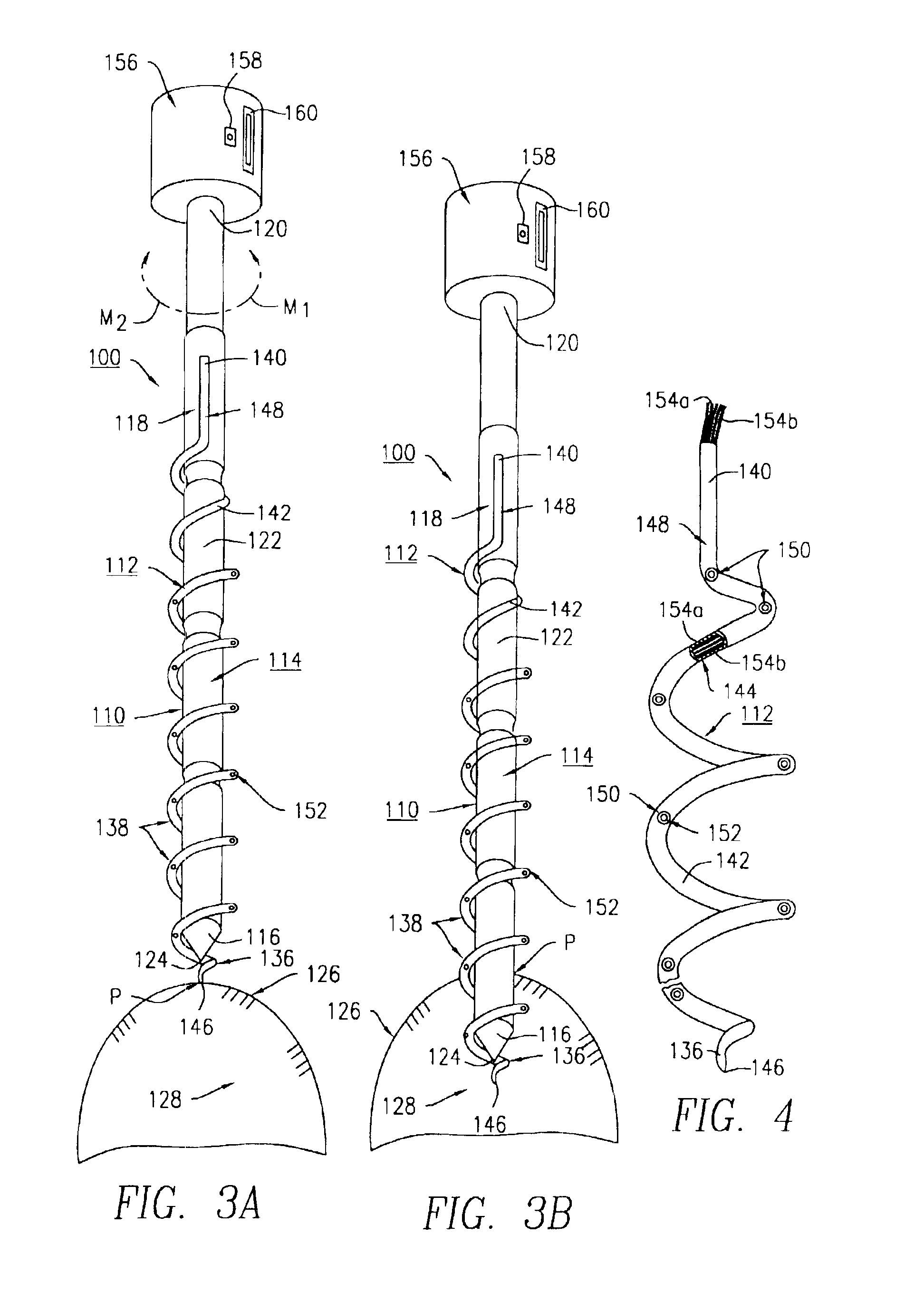 Helical device and method for aiding the ablation and assessment of tissue