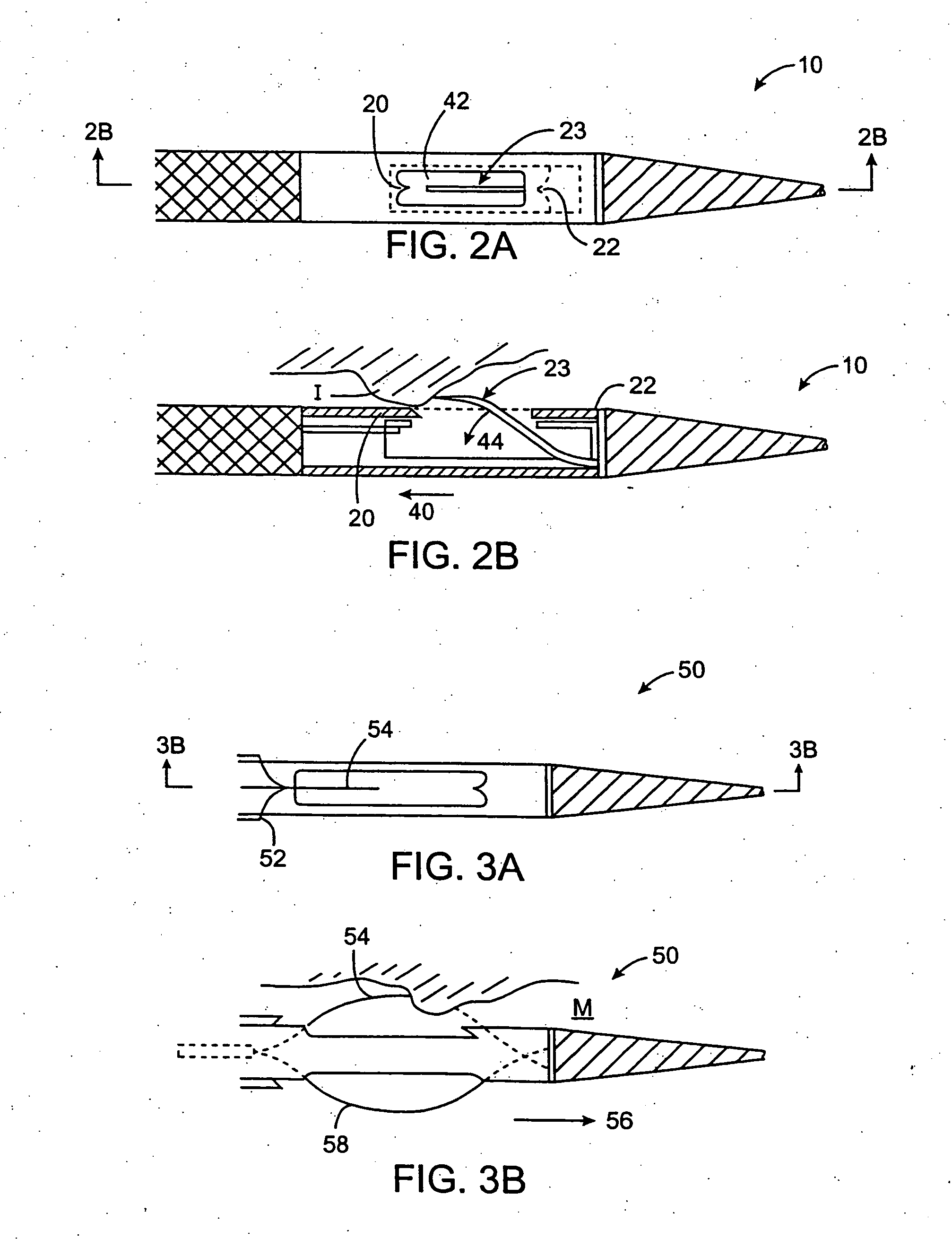 Apparatus and methods for material capture and removal