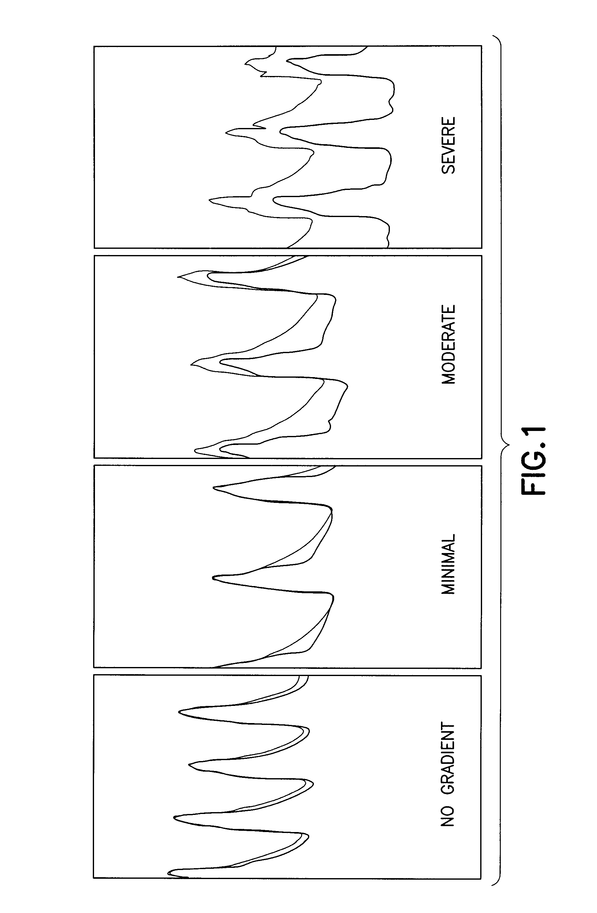 Method and apparatus for fractional flow reserve measurements
