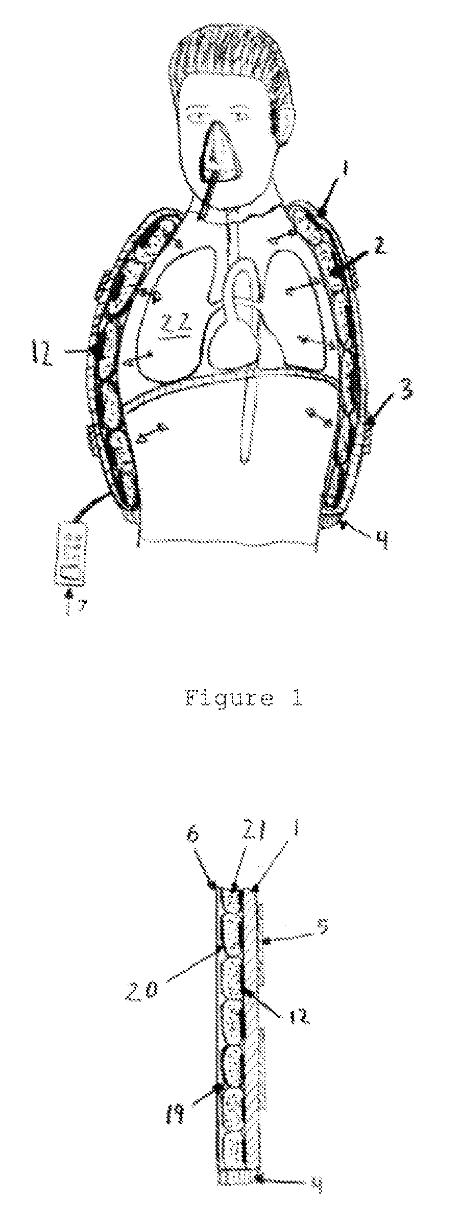 Low Frequency Lung Vibration and Sputum Removal Apparatus