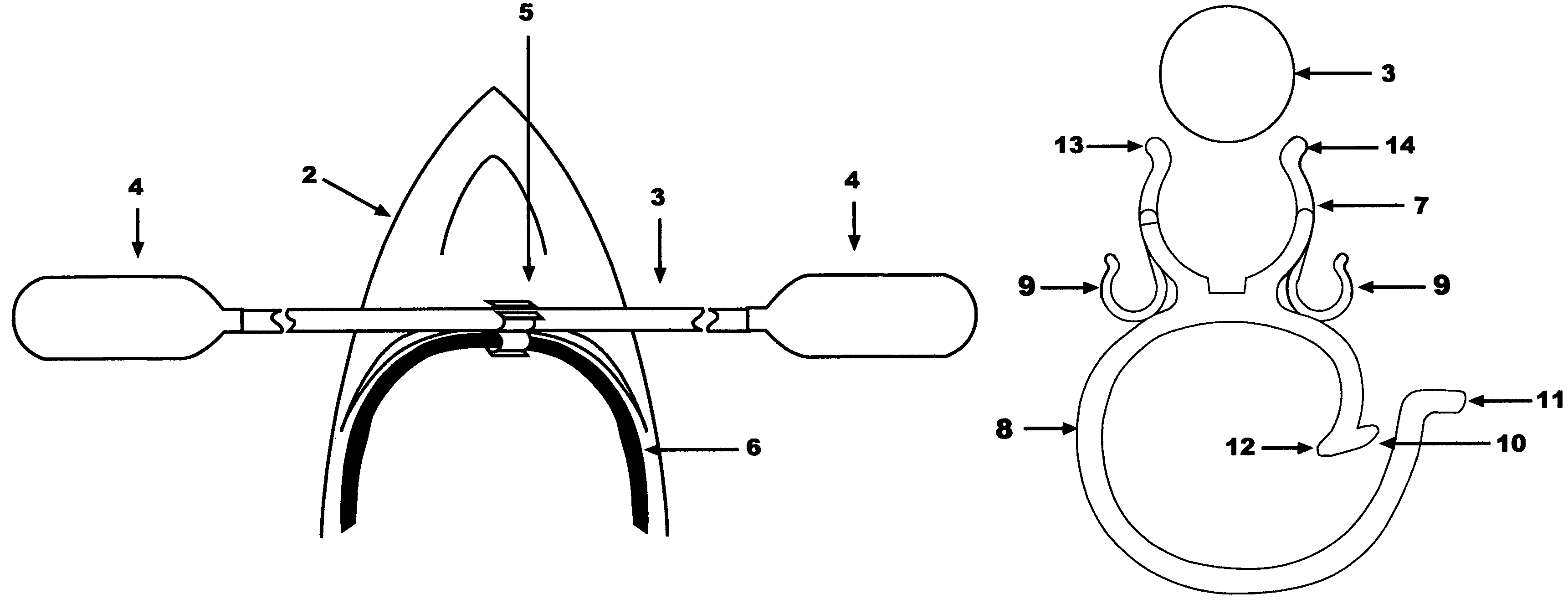 Paddle clip and method for using same