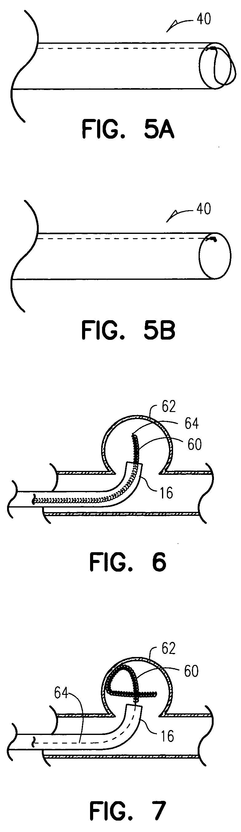 Aneurysm embolization material and device