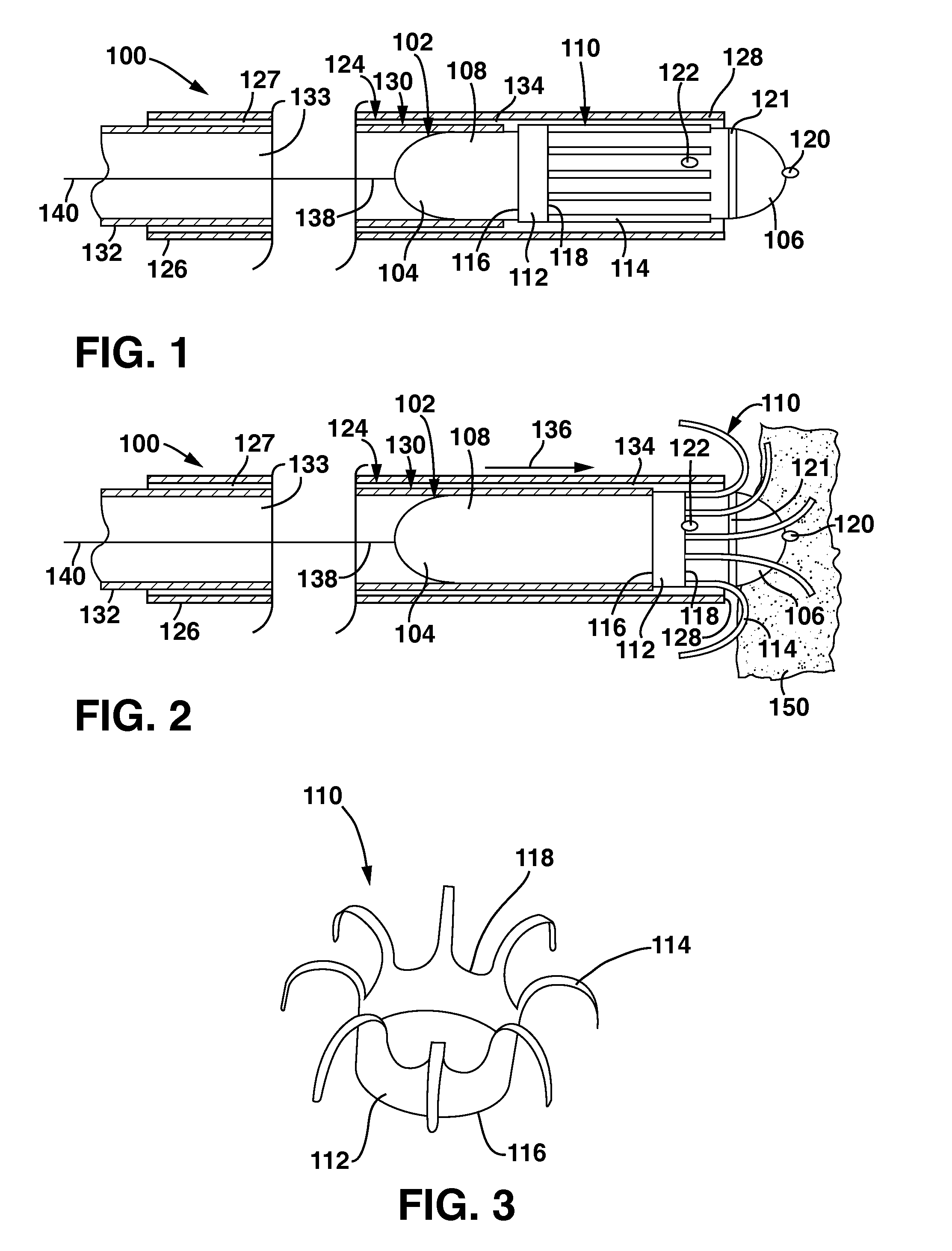 Slidable Fixation Device for  Securing a Medical Implant