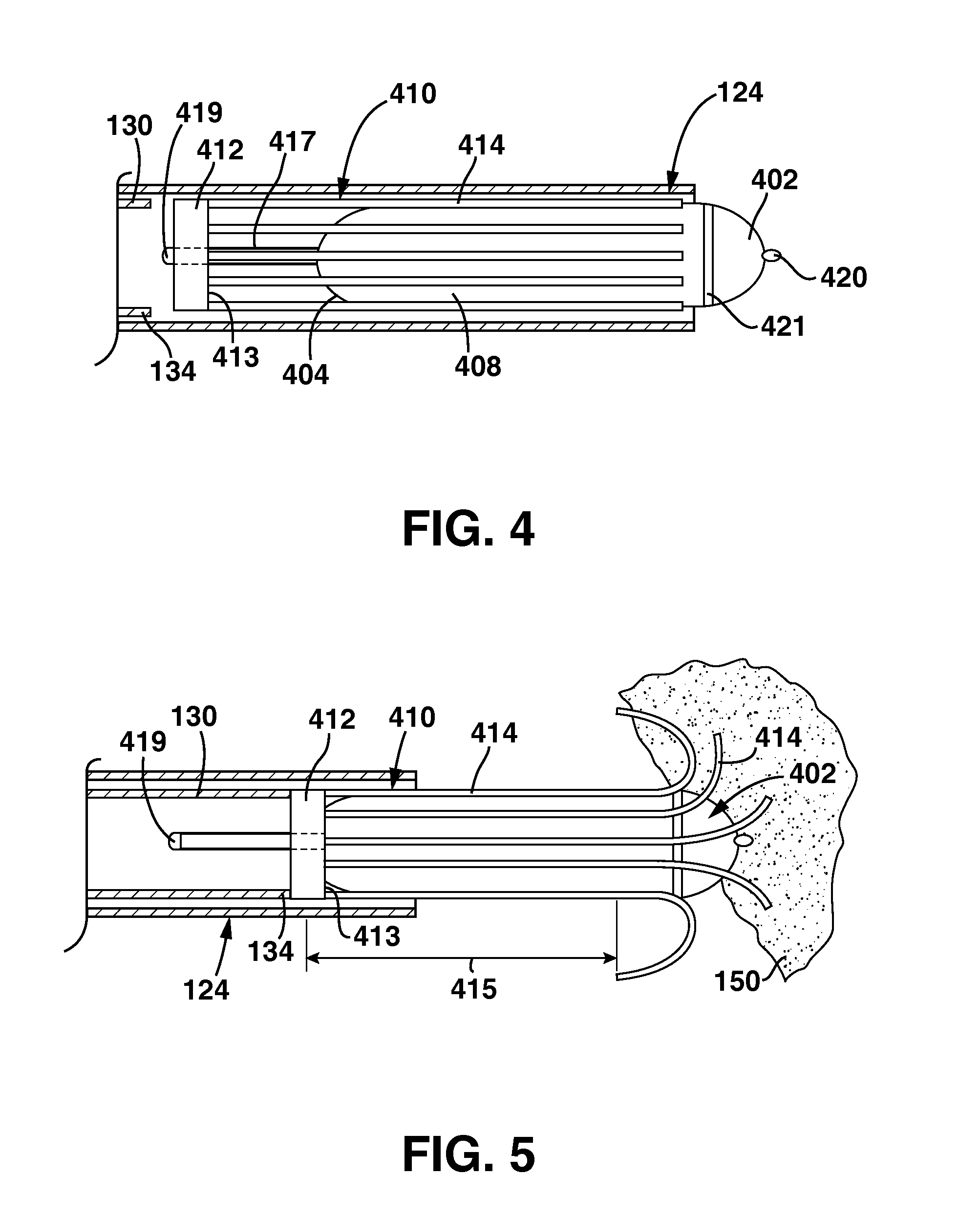 Slidable Fixation Device for  Securing a Medical Implant