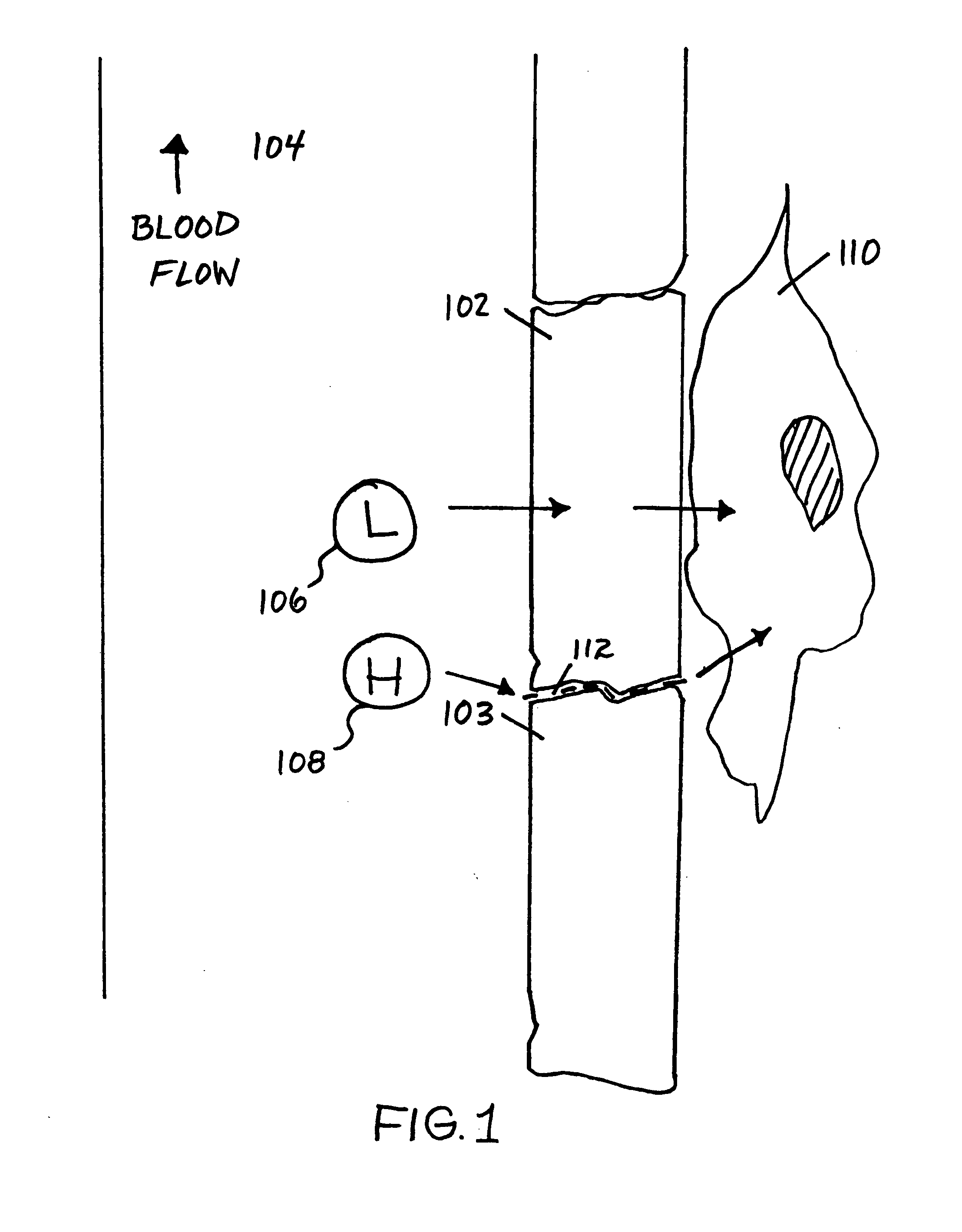 Non-invasive methods and related compositions for identifying compounds that modify in vivo aggregations of disease-related polypeptides