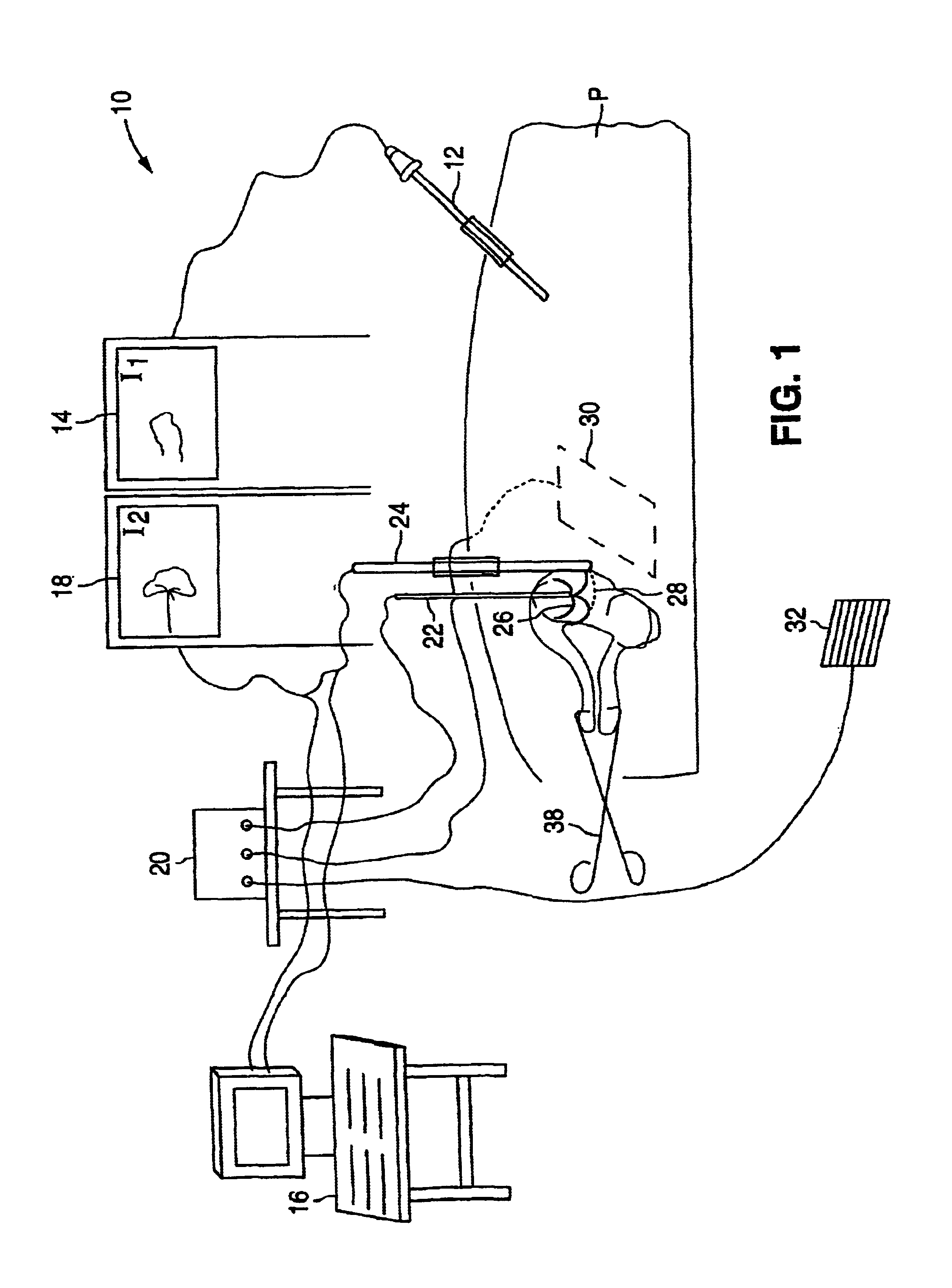 Gynecological ablation procedure and system using an ablation needle