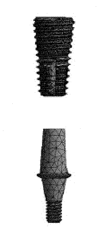 Prosthesis for dental replacement, method of redistributing stress and stress analysis method