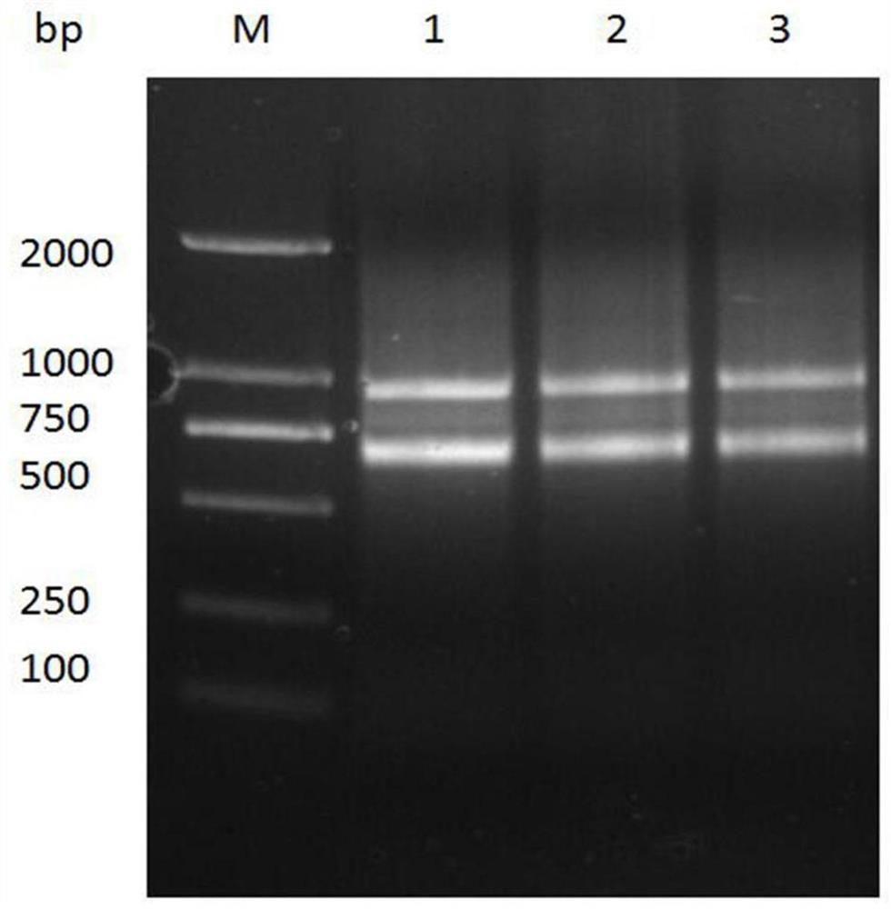 An anti-afp nanobody 1c5 and its application