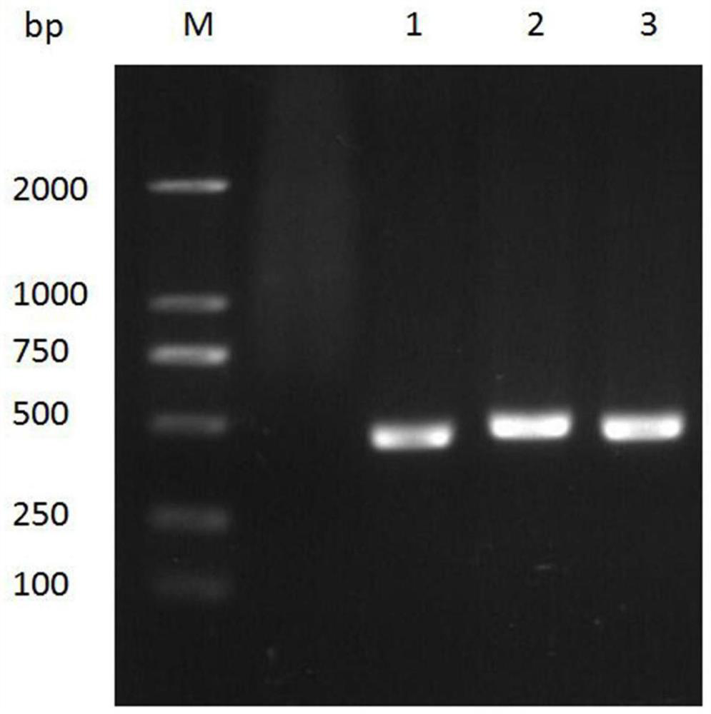 An anti-afp nanobody 1c5 and its application