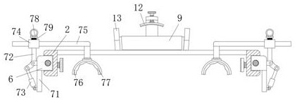 Radiotherapy clinical fixing frame for radiotherapy department physician