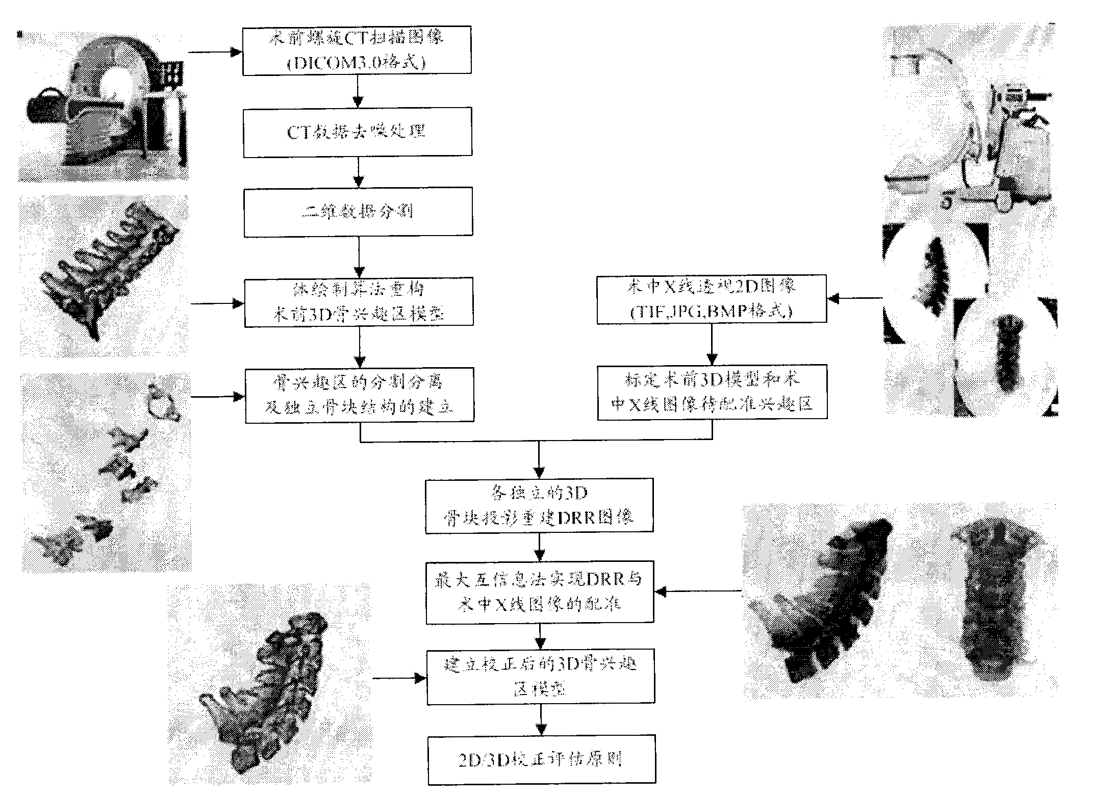 Intraoperative registration method for correcting preoperative three-dimensional image and device