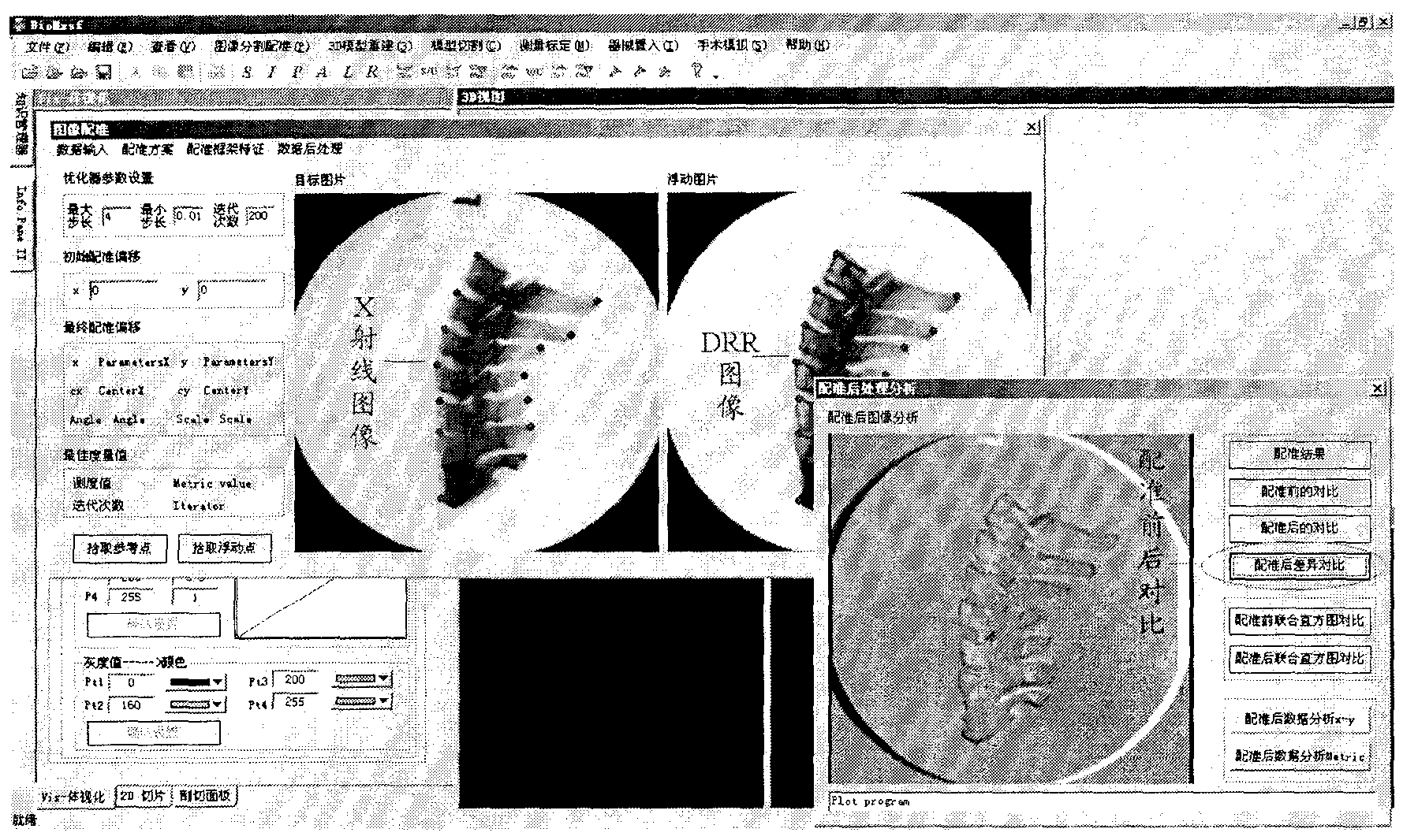 Intraoperative registration method for correcting preoperative three-dimensional image and device