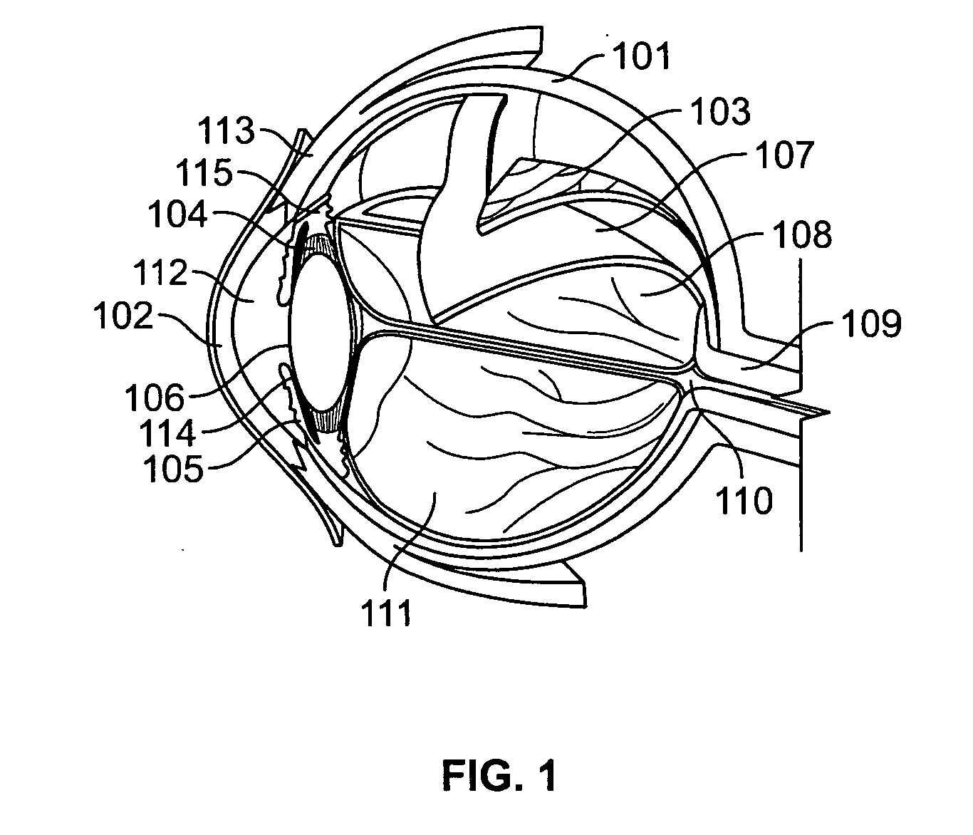 Apparatus and processes for preventing or delaying one or more symptoms of presbyopia