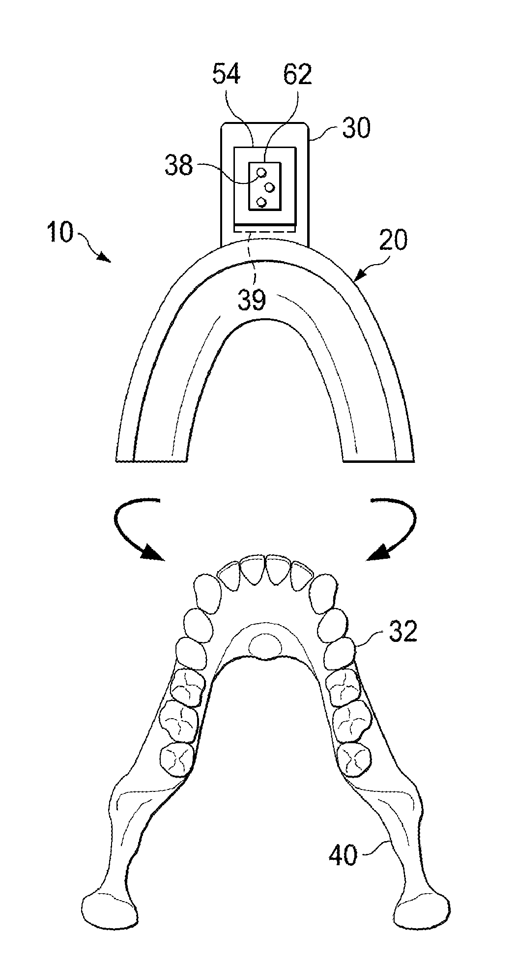 Vibrating orthodontic remodeling device and method thereof