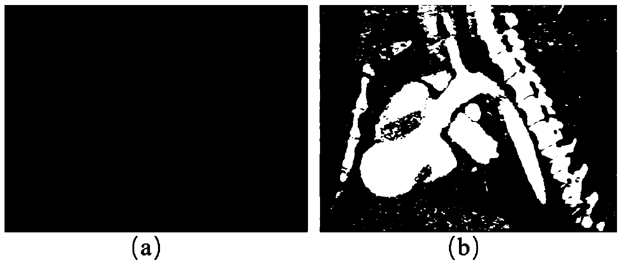 A three-dimensional spherical index determination method based on a CTA image