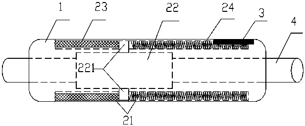 Implantable controllable blood vessel locking device