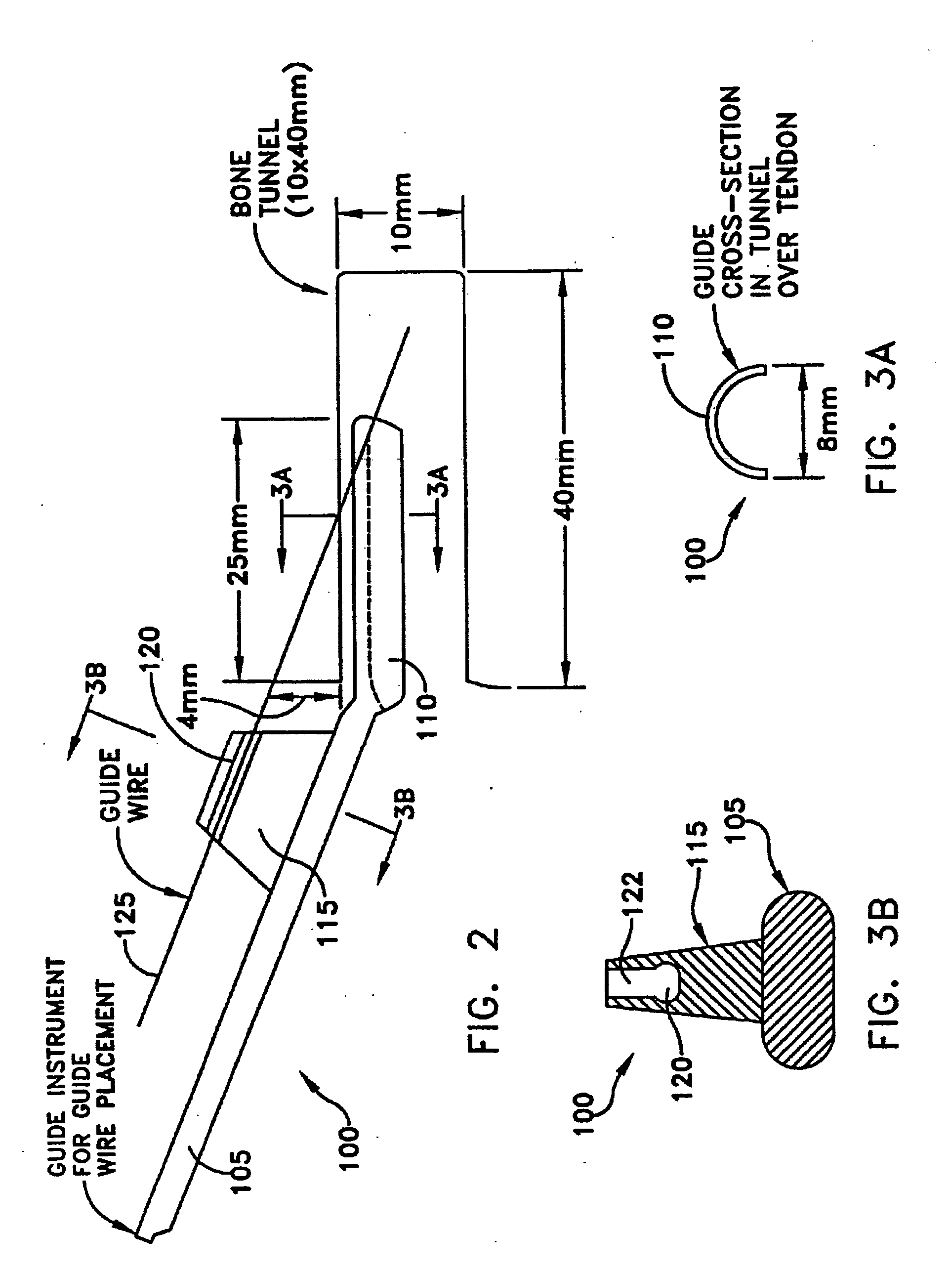 Method and apparatus for reconstructing a ligament