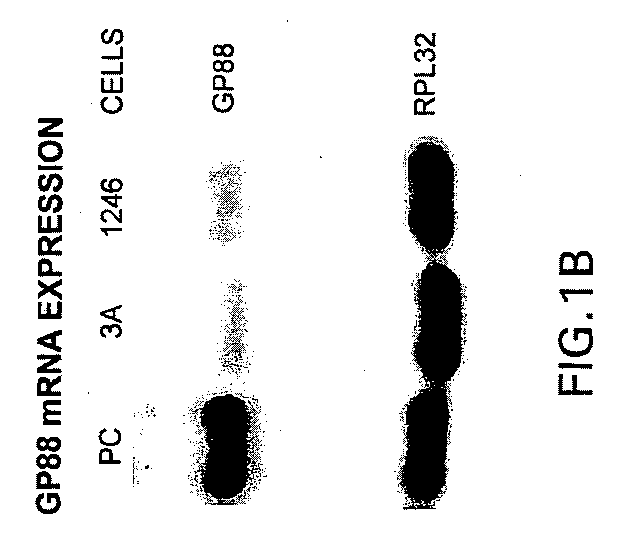 88kDa tumorigenic growth factor and antagonists