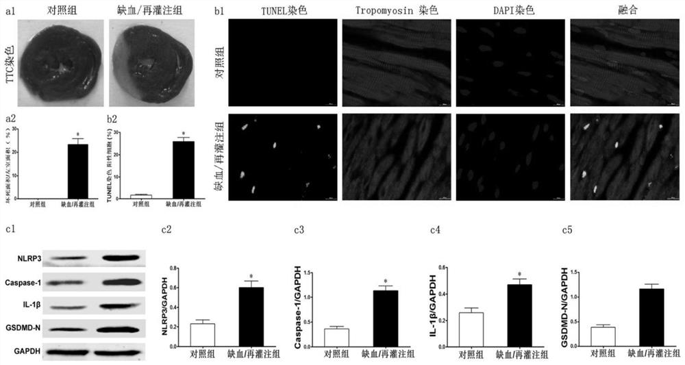 Model construction of influence of endoplasmic reticulum stress on NLRP3 on myocardial ischemia