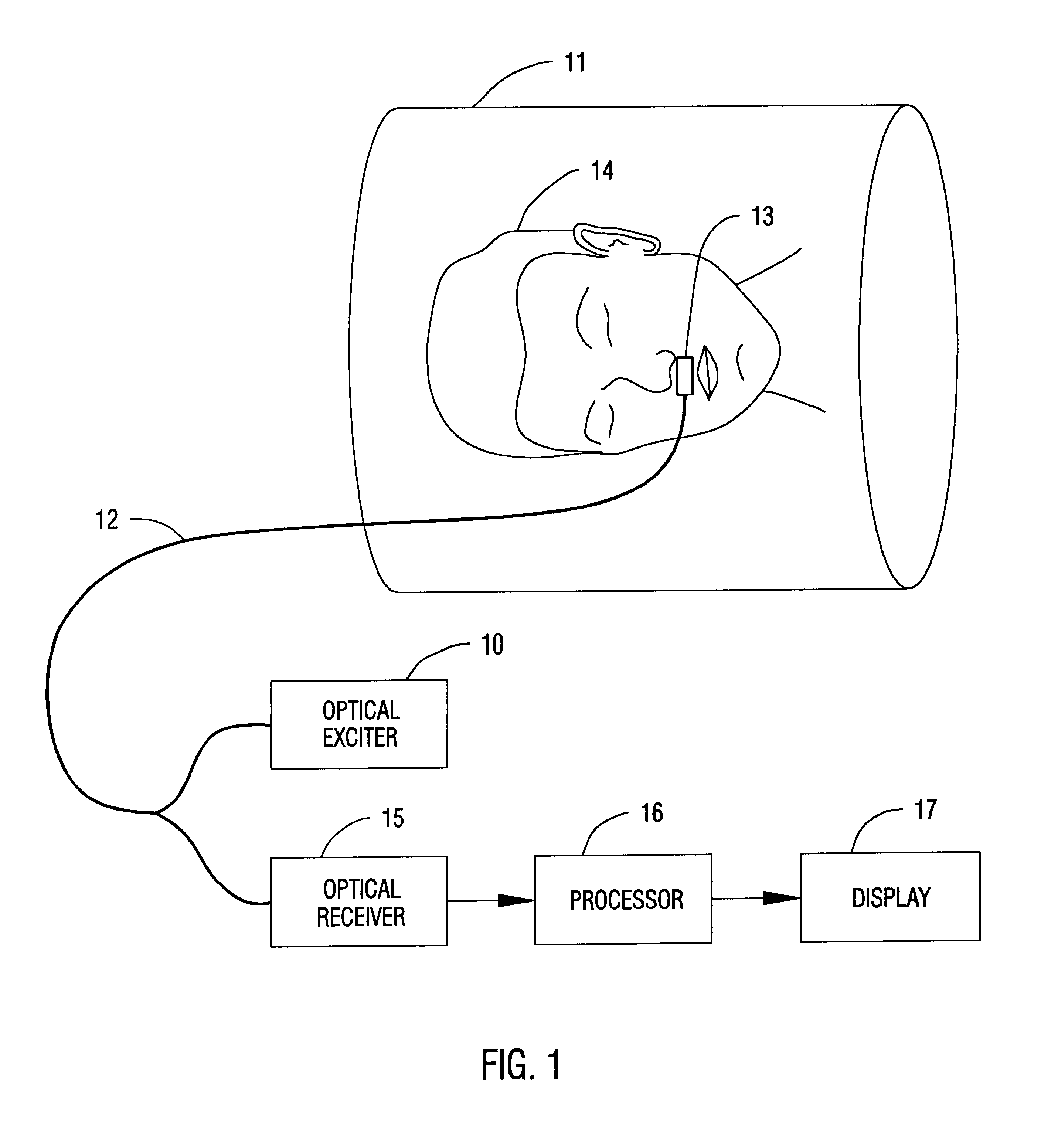 Method and apparatus for monitoring the breathing of a patient during magnetic resonance imaging
