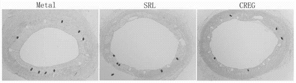 Medical appliance containing recombinant hCREG protein and preparation method of medical appliance