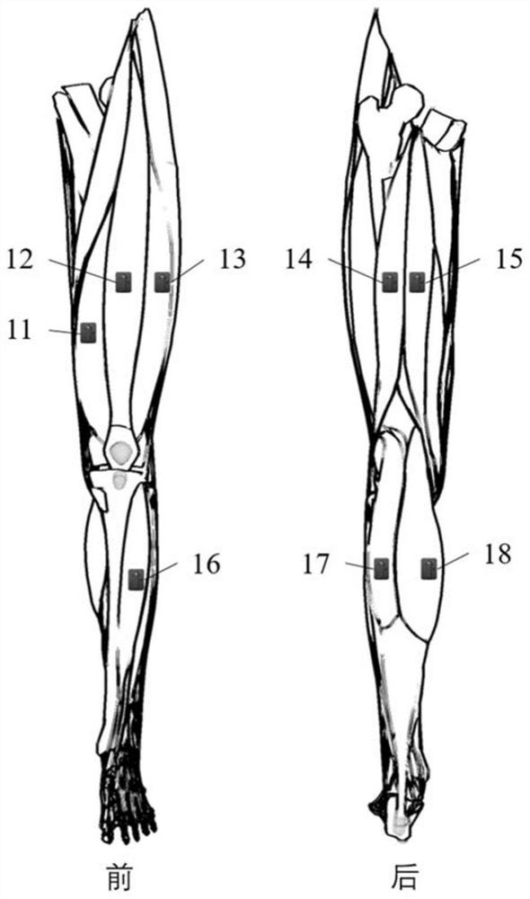 Lower limb artificial limb continuous control system driven by electromyographic signals