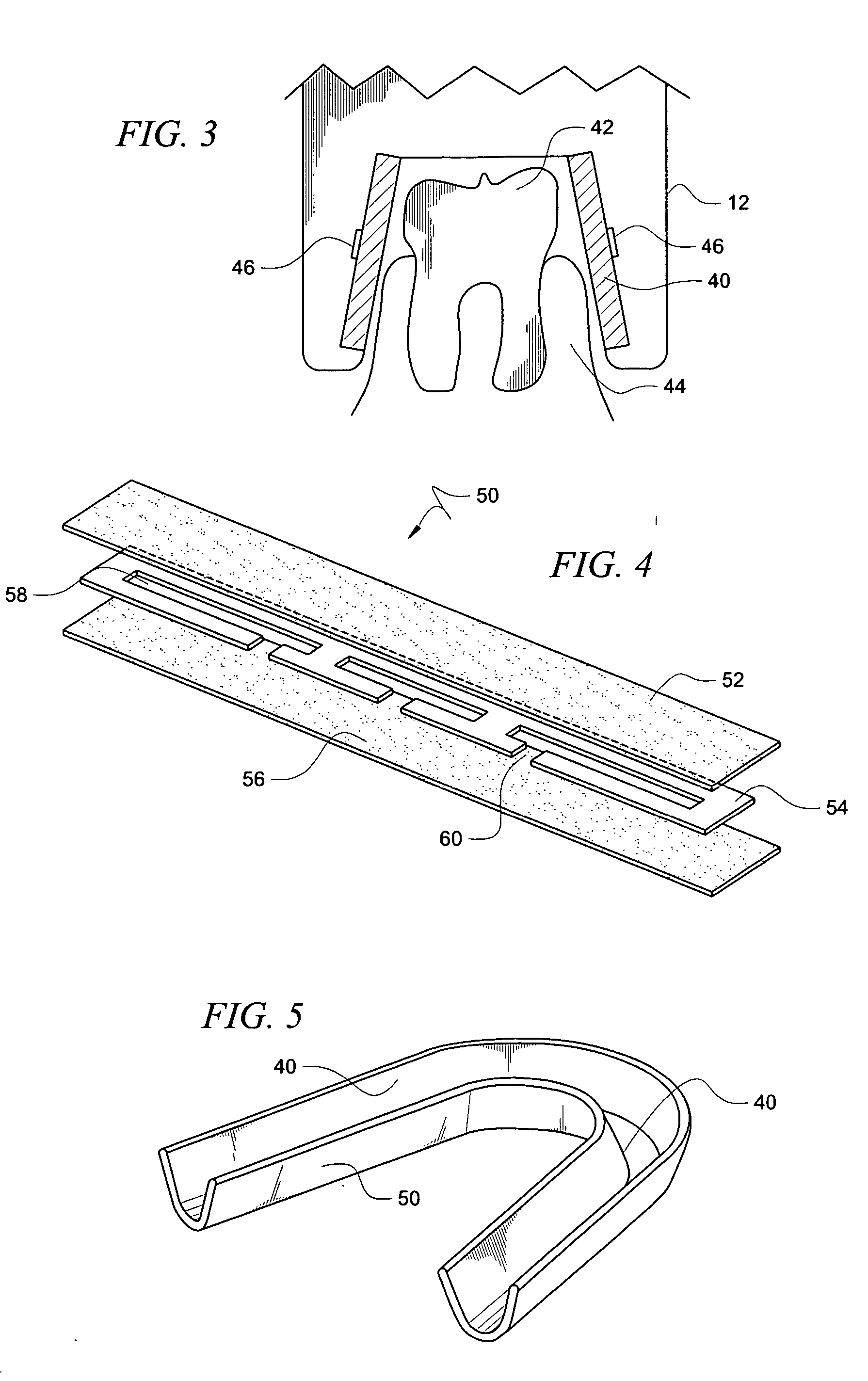 Treatment device and method for treating or preventing periodontal disease through application of heat