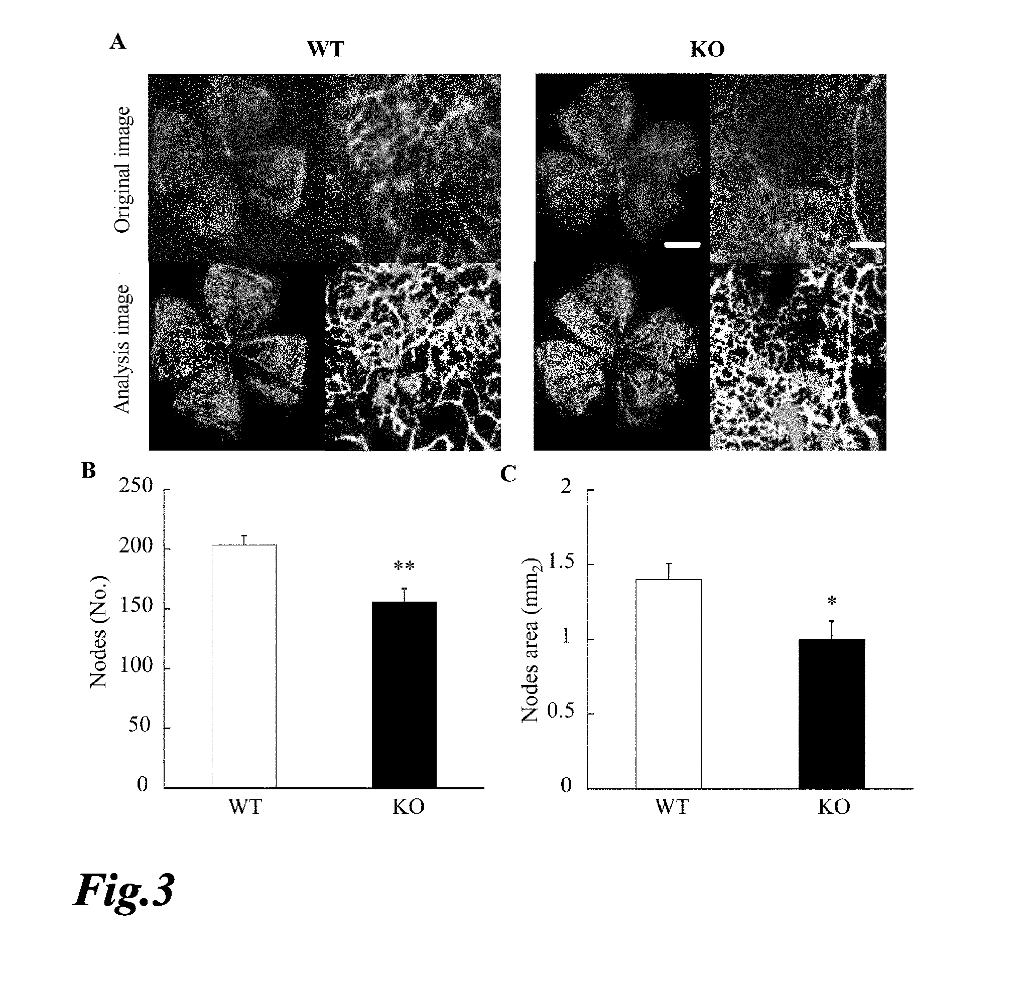 Intraocular angiogenesis inhibitor and uses thereof