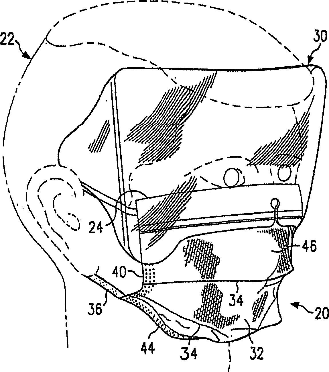Facemasks containing an anti-fog/anti-glare composition