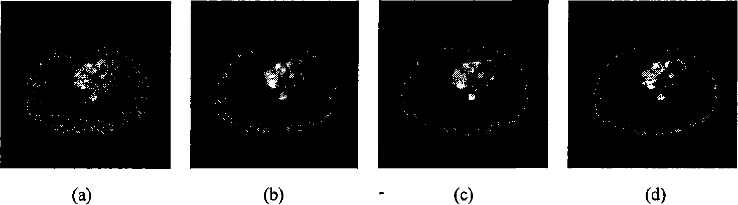 Maximum posteriori optimizing image rebuilding method in PET imaging