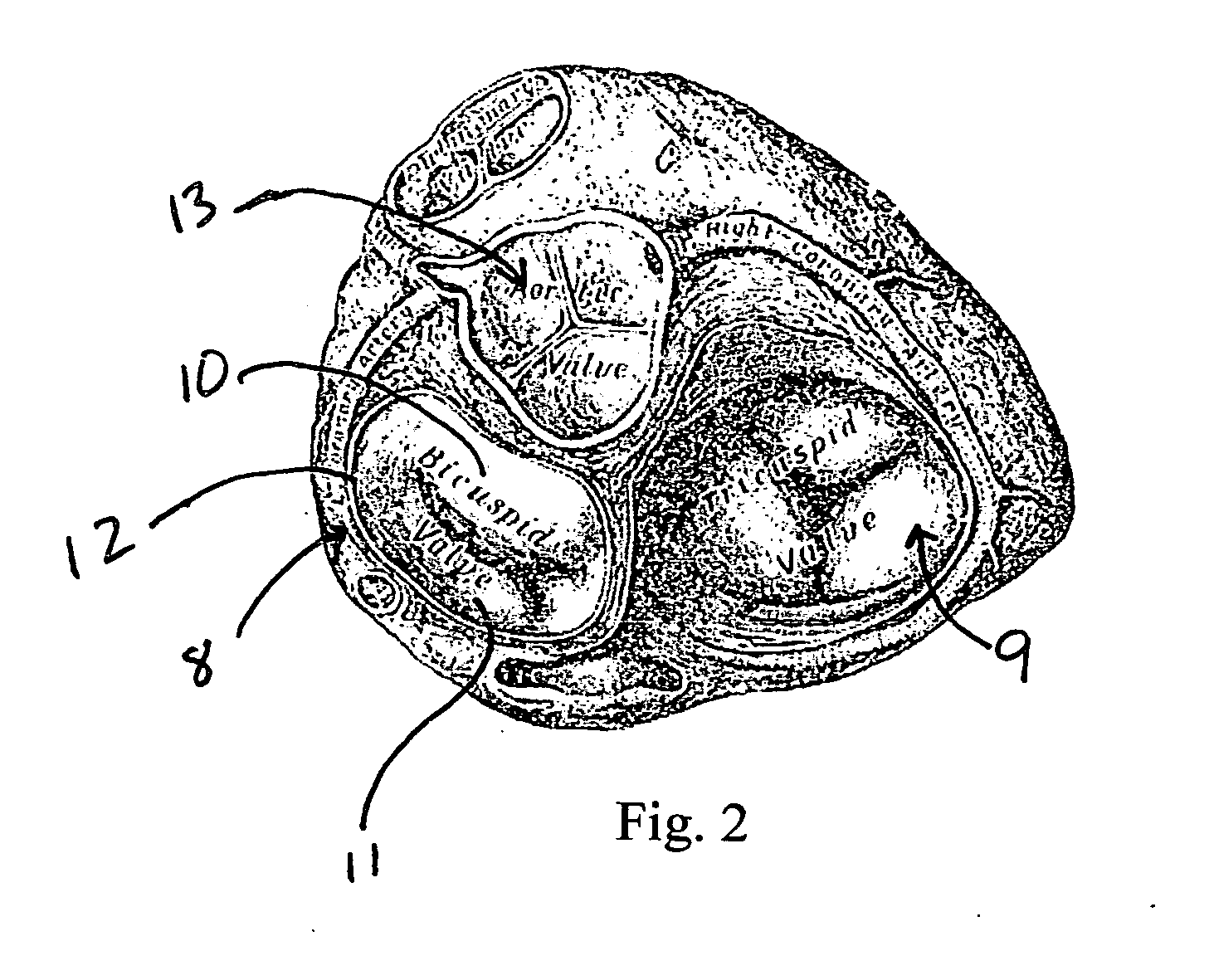 Anchoring and tethering system