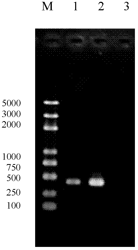 Method for assisting in detecting and identifying histamine-producing enterobacteria