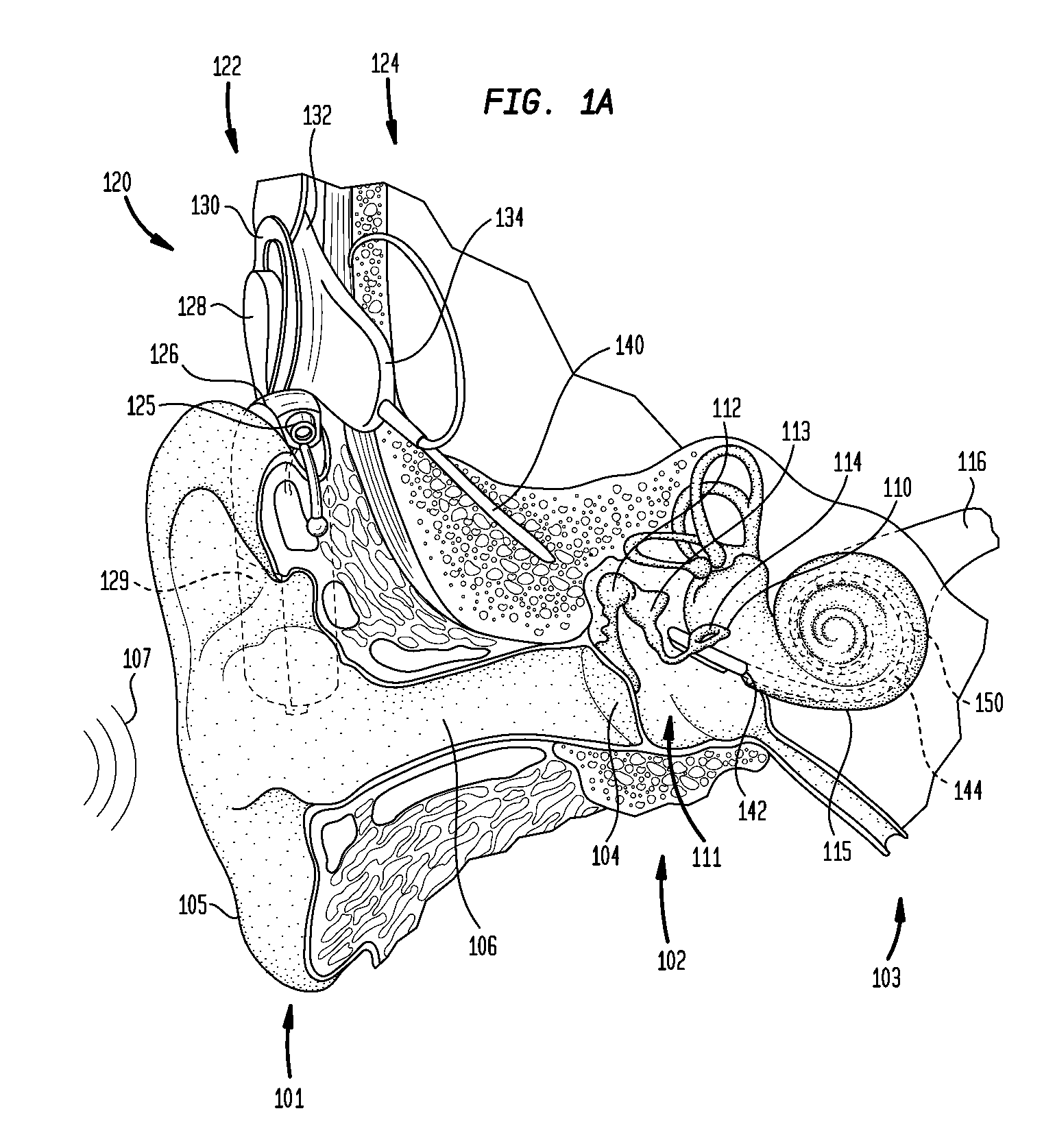 Complimentary drug delivery sheath for an implantable medical device
