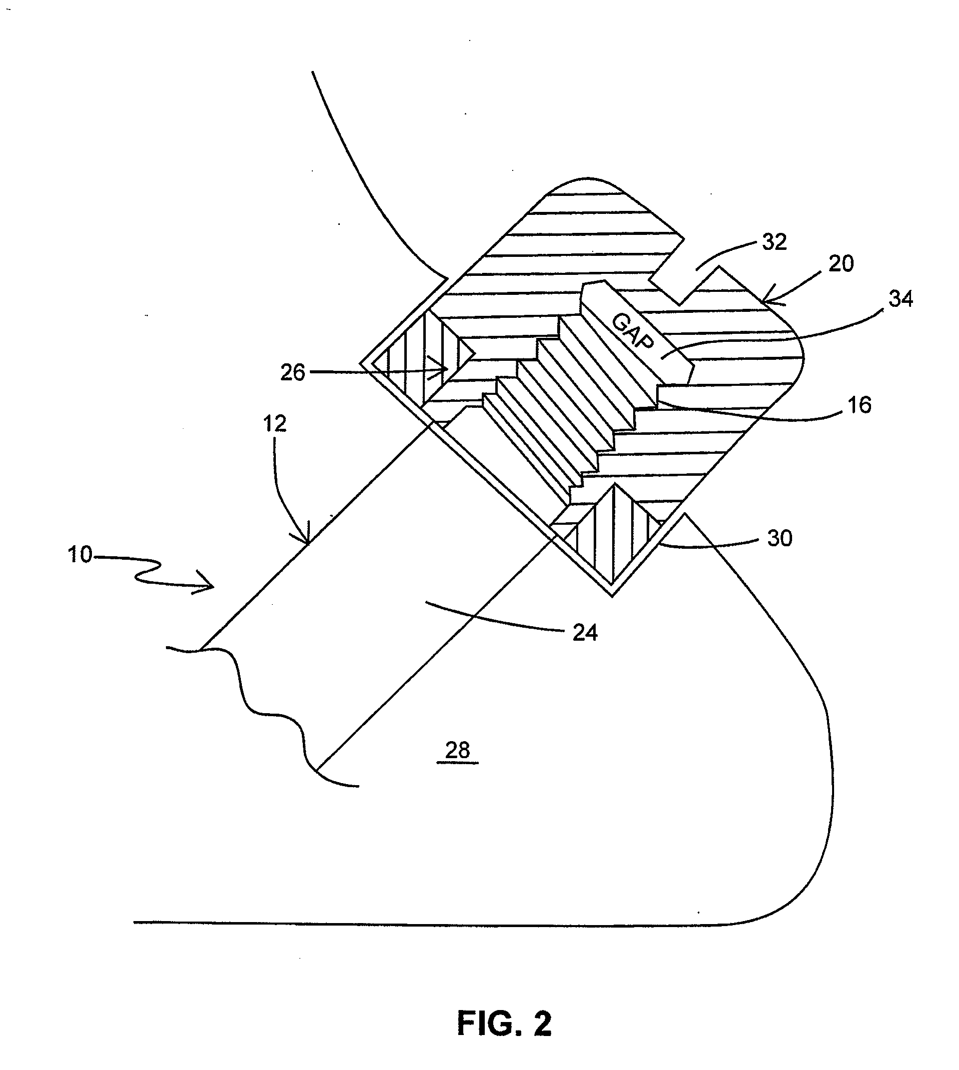 Orthopedic implant having non-circular cross section and method of use thereof