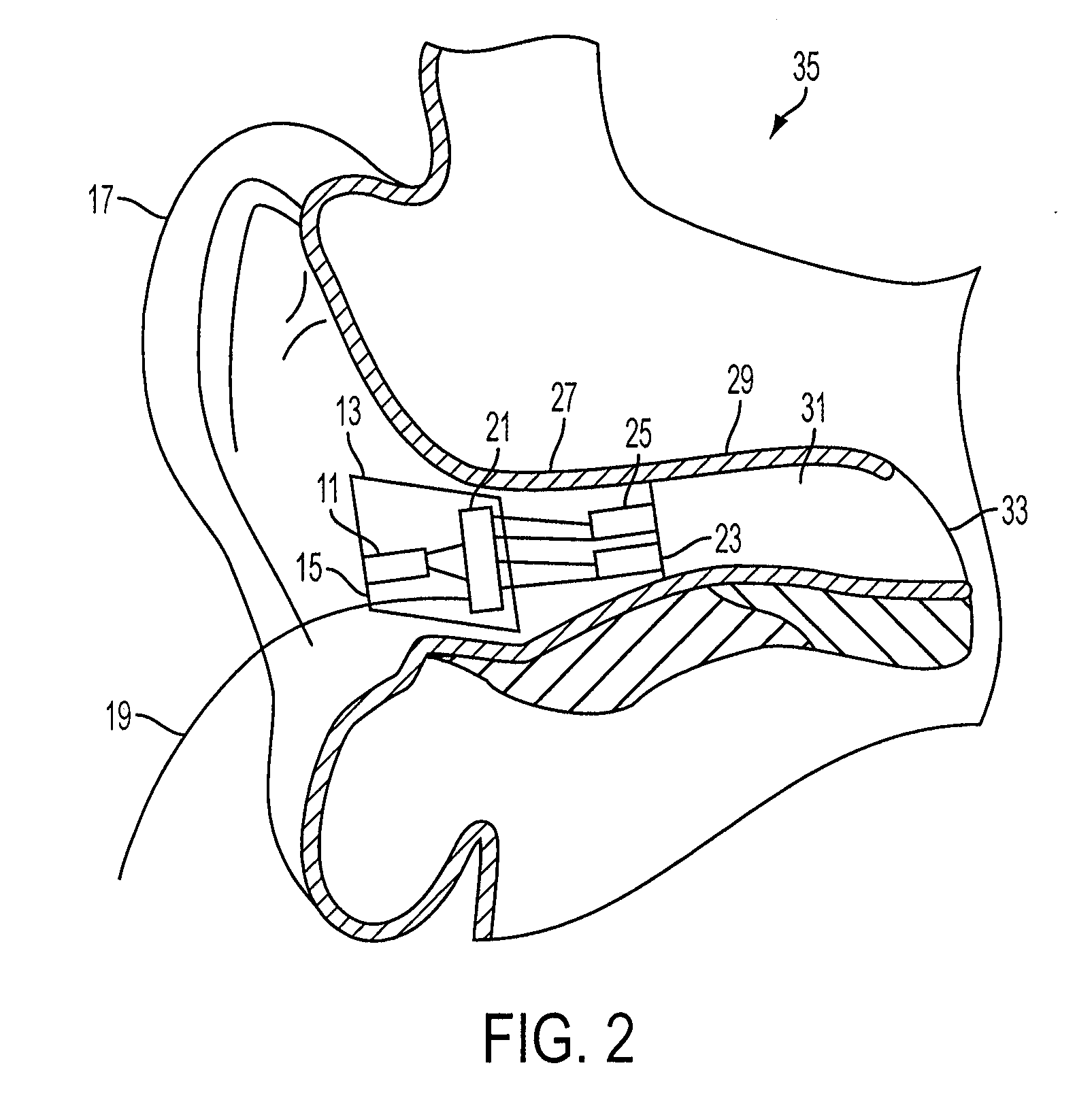 Earhealth monitoring system and method iv
