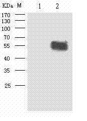 Riemerella anatipestifer-escherichia coli shuttle expression vector as well as construction method and application thereof