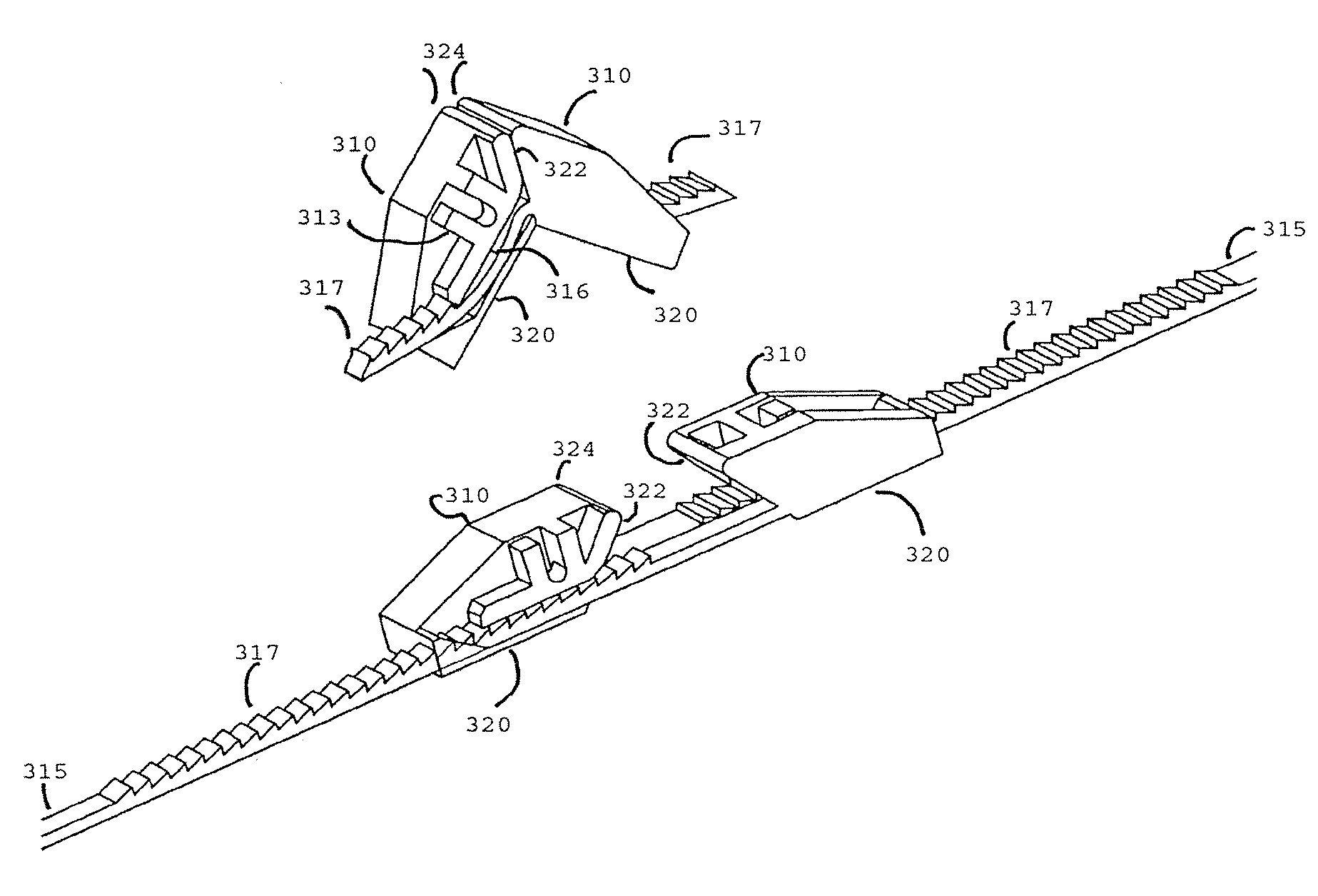 Systems and methods for closing a tissue opening
