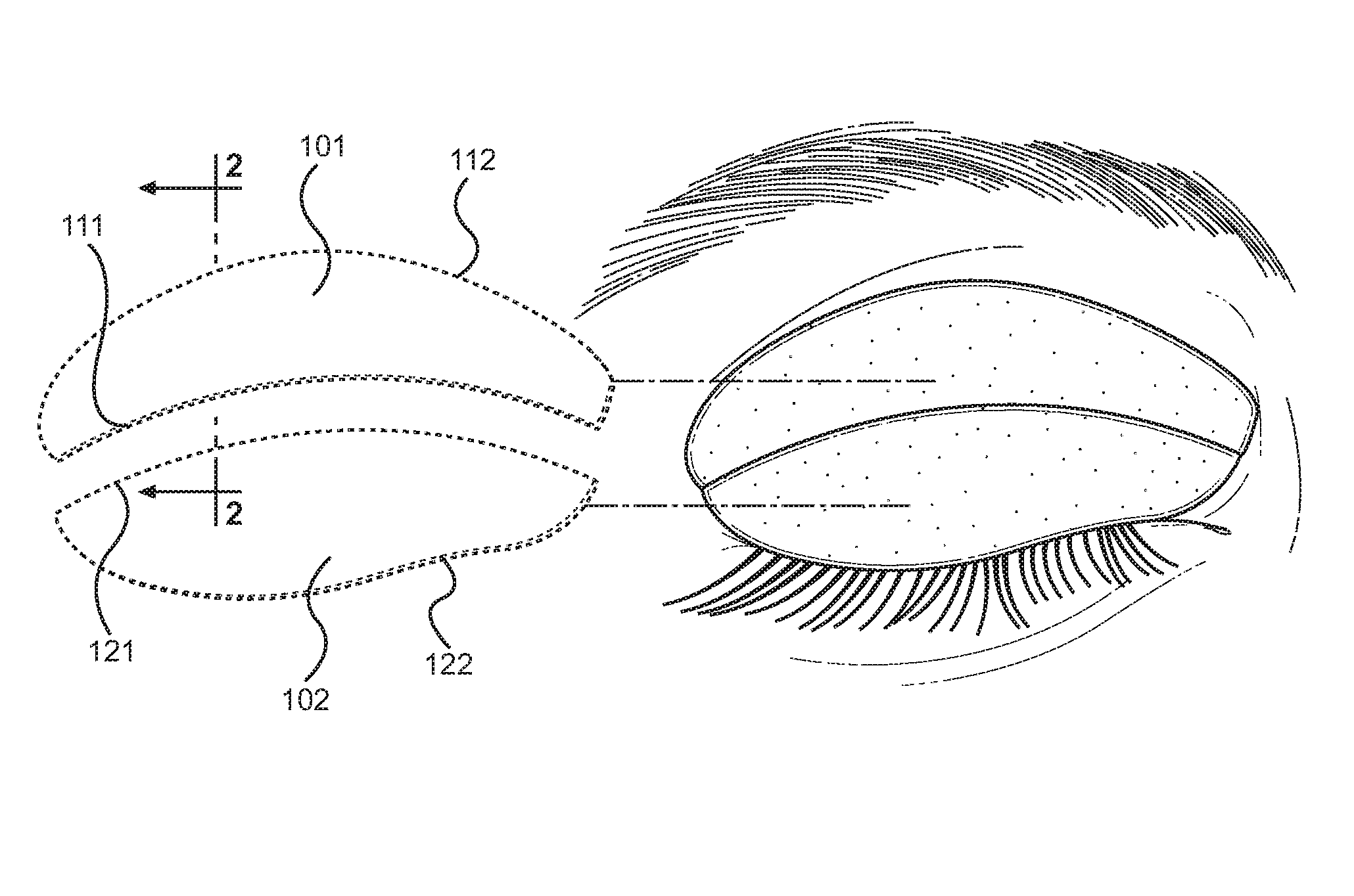 Eyelid Cosmetic Template