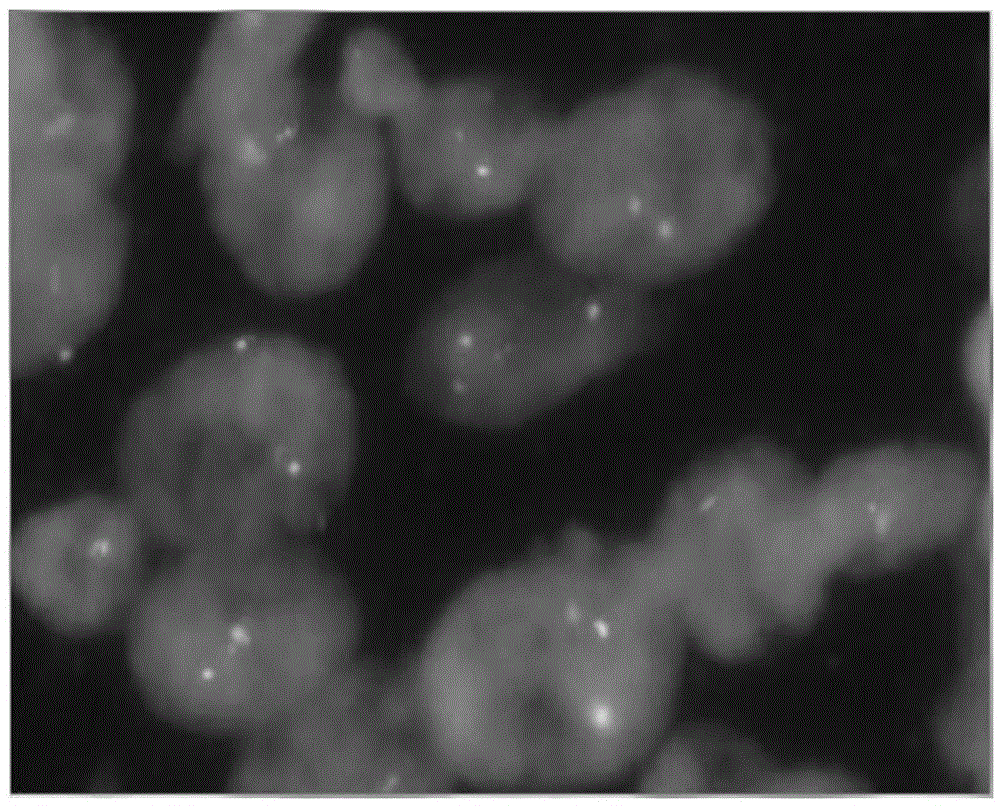 TOP2A gene detection probe, preparation method thereof and reagent kit